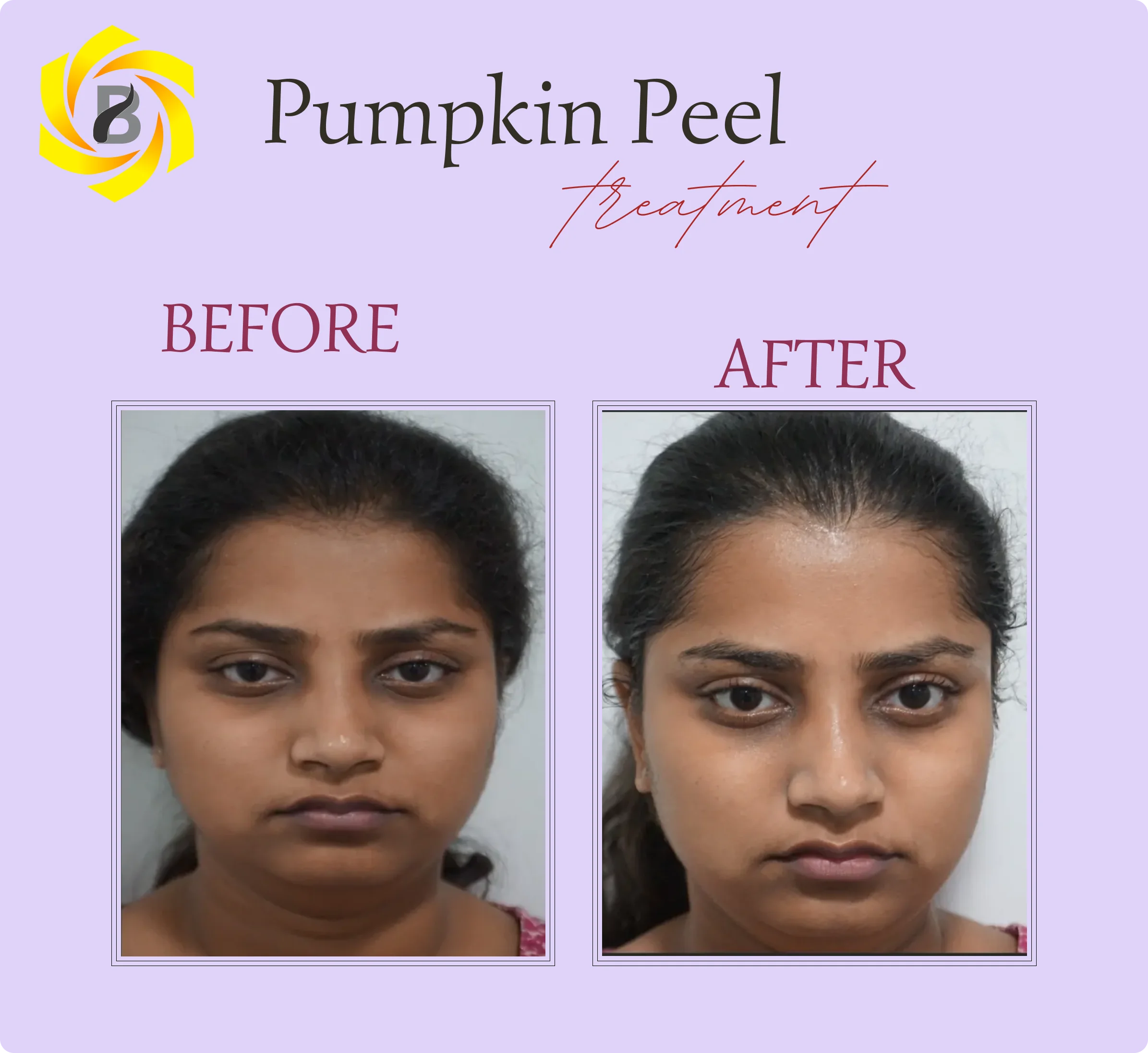 Before & After Result