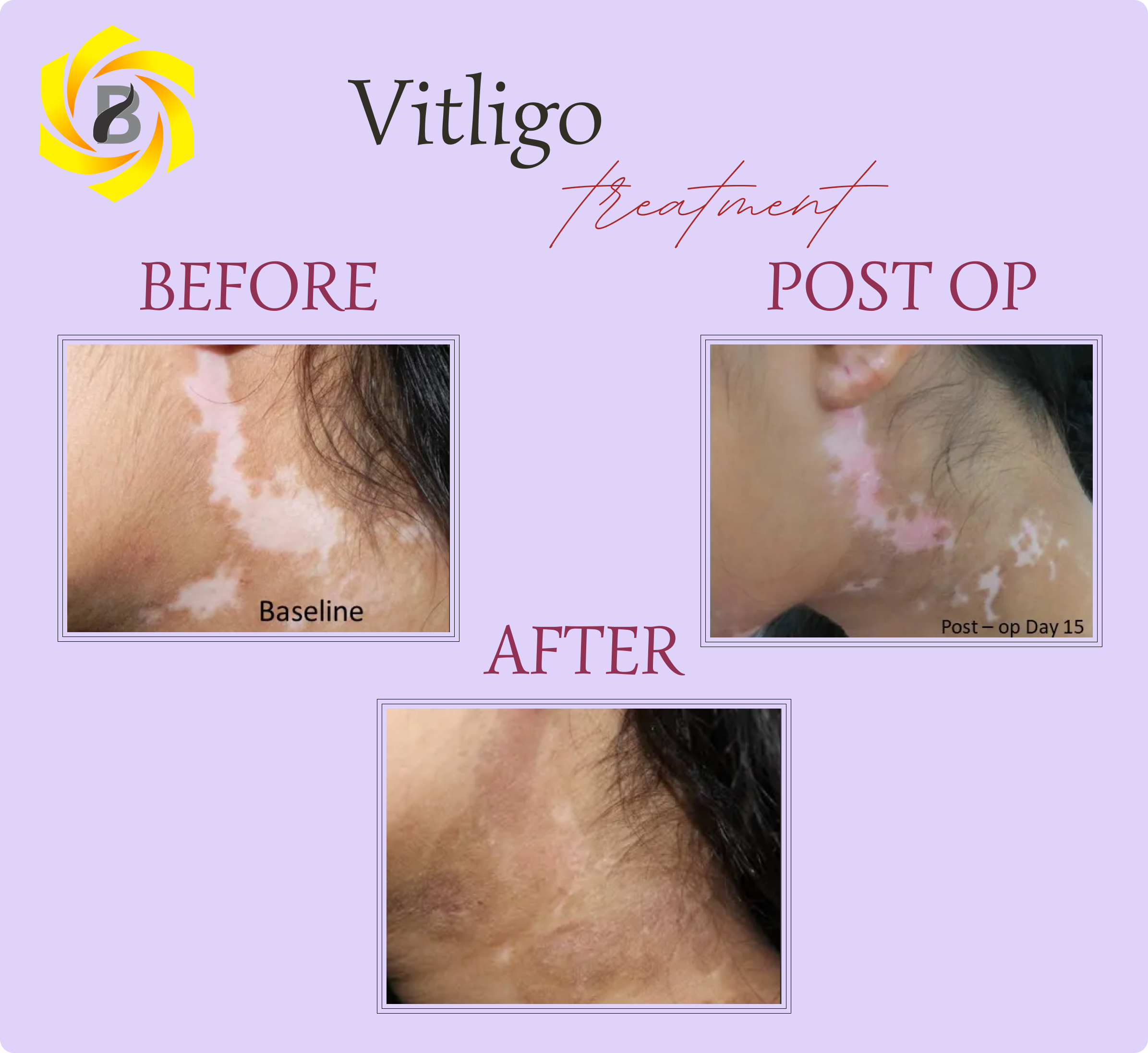 Before & After Result