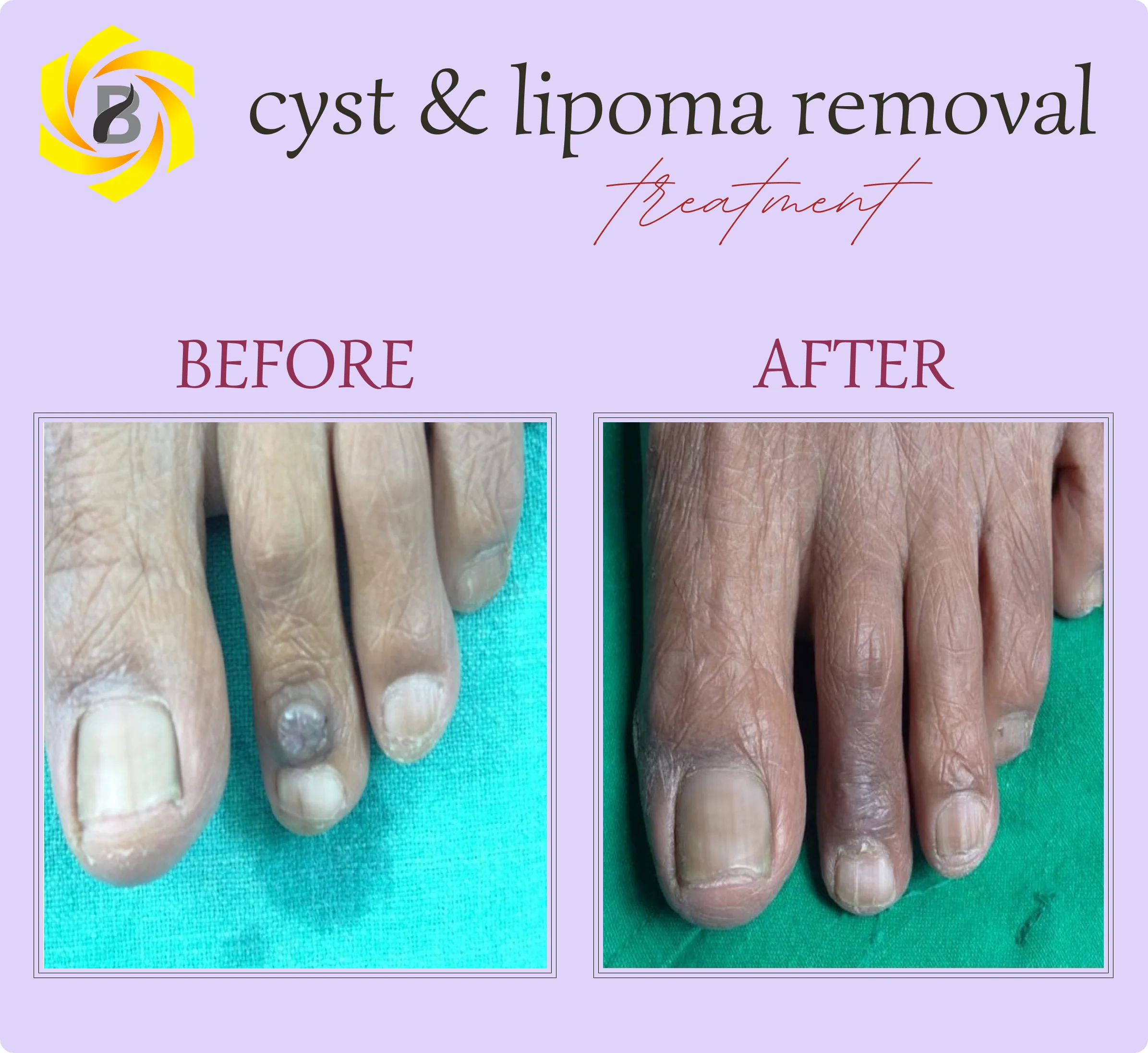Before & After Result