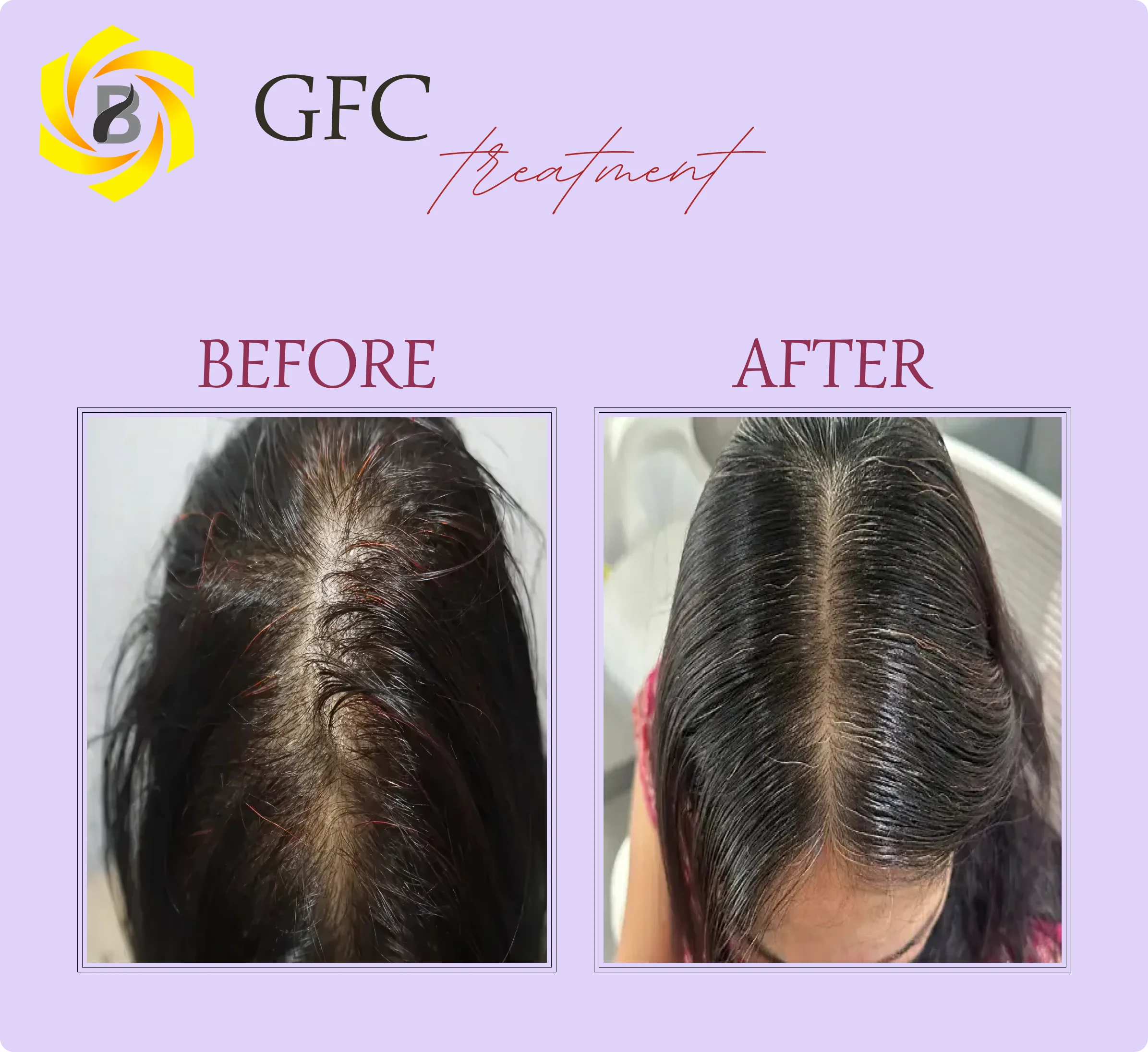 Before & After Result 1