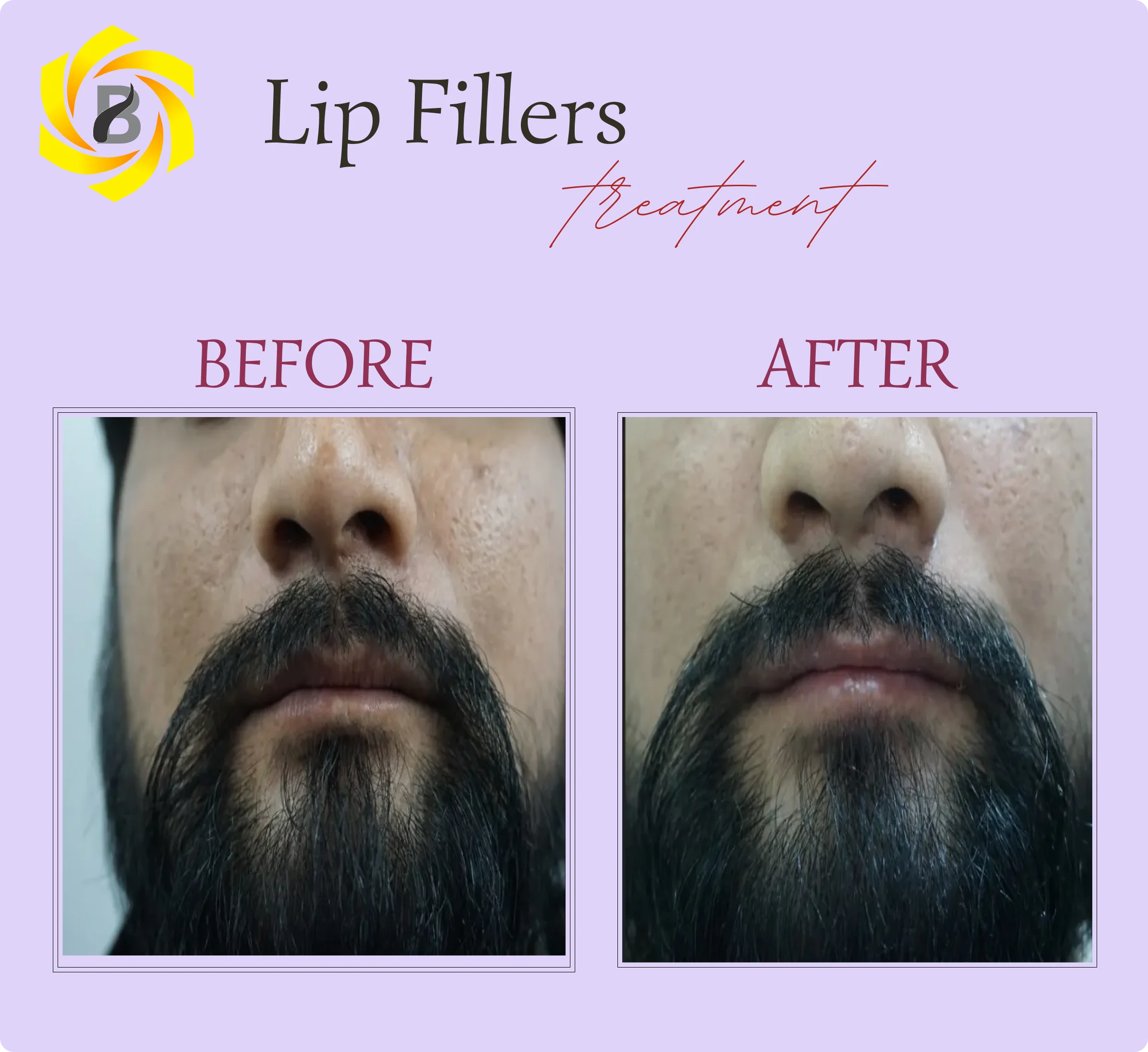Before & After Result 3