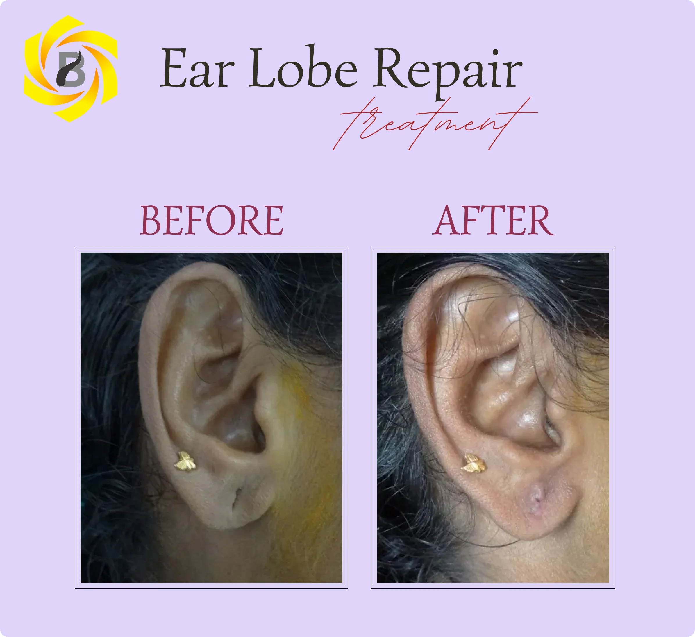 Before & After Result