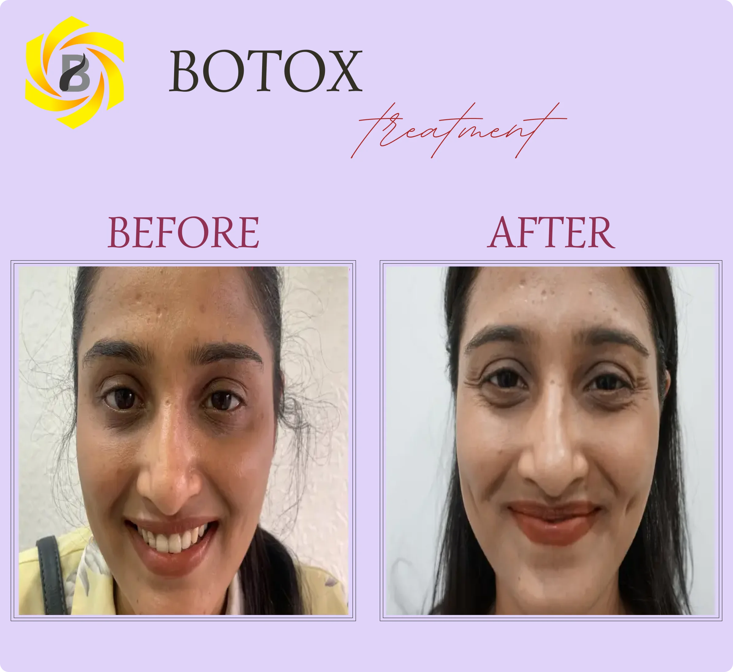 Before & After Result 1