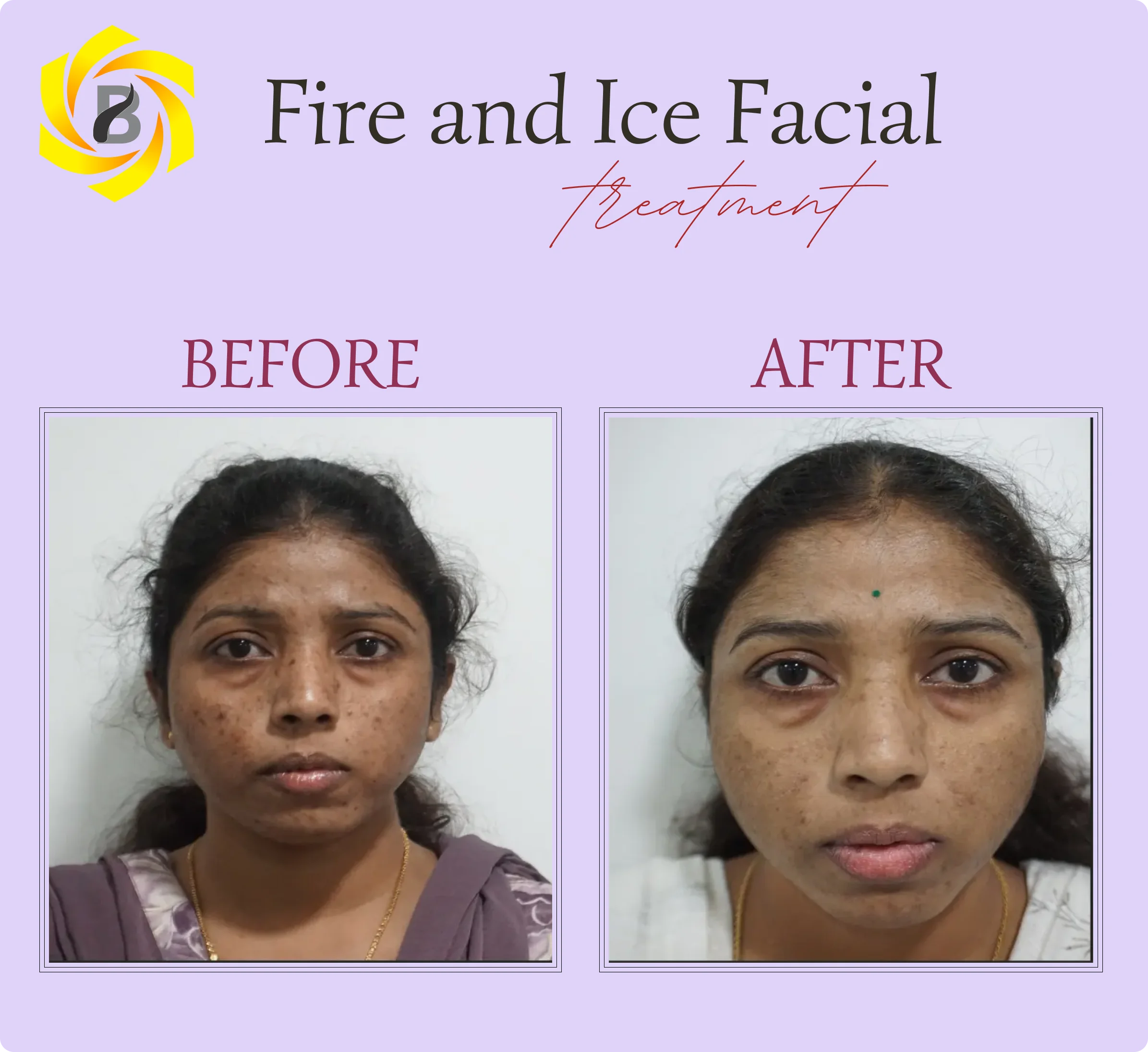 Before & After Result