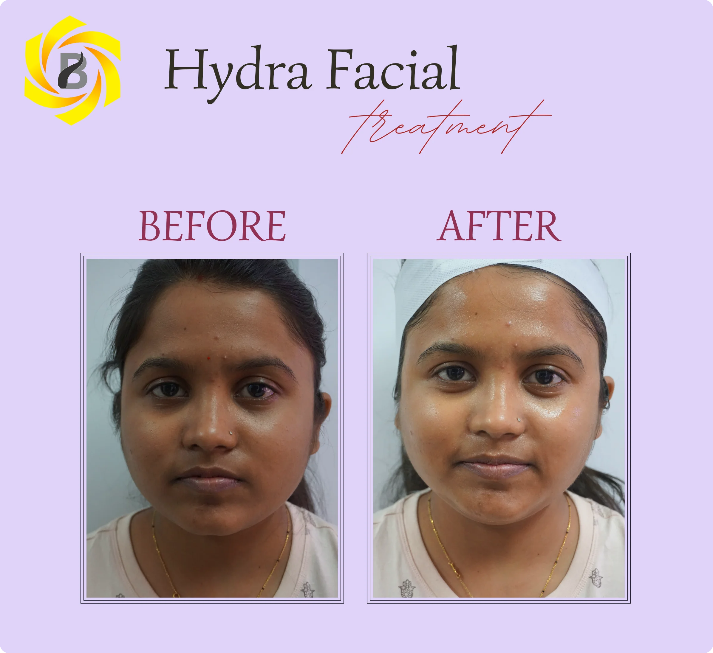 Before & After Result