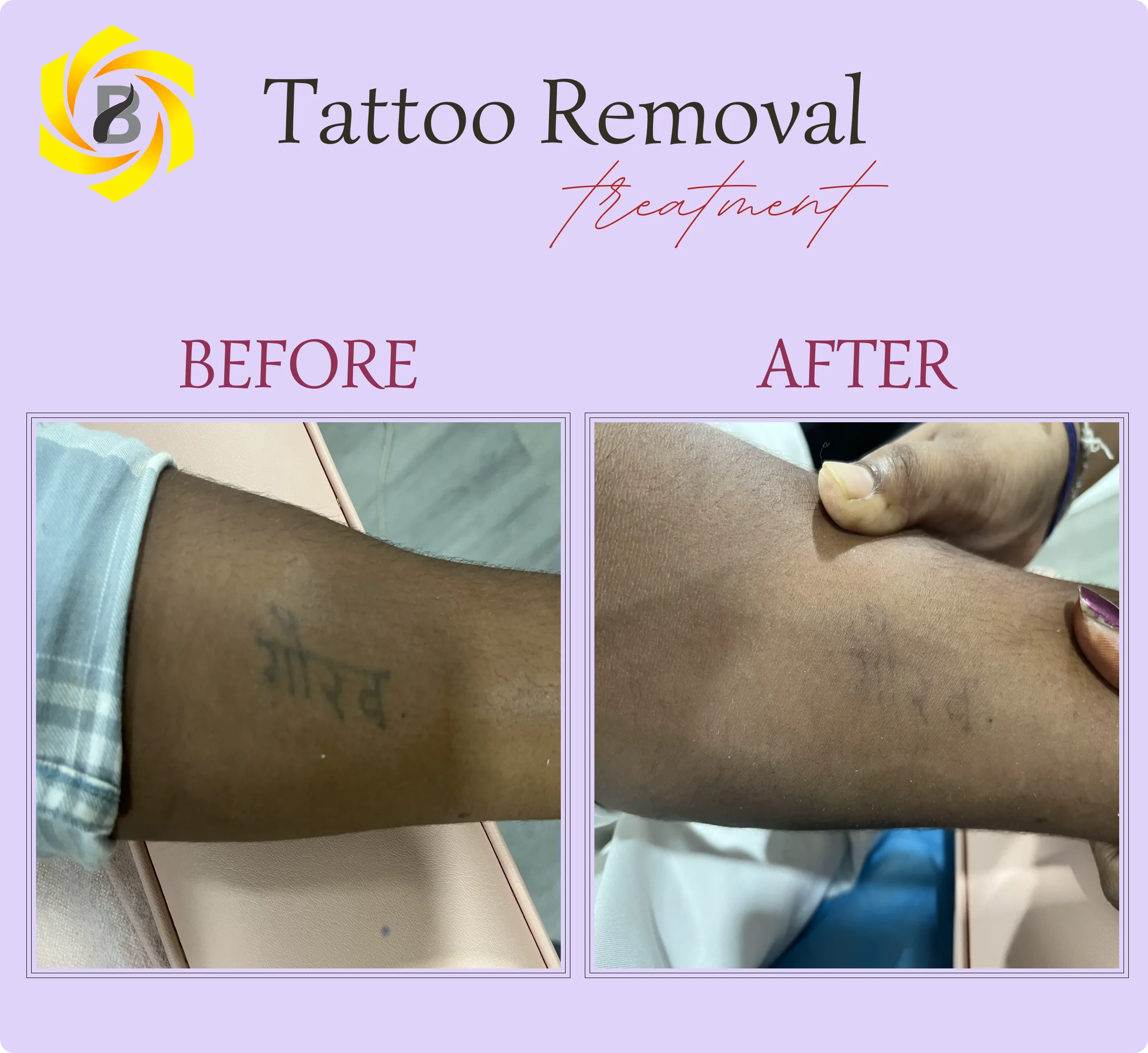 Before & After Result