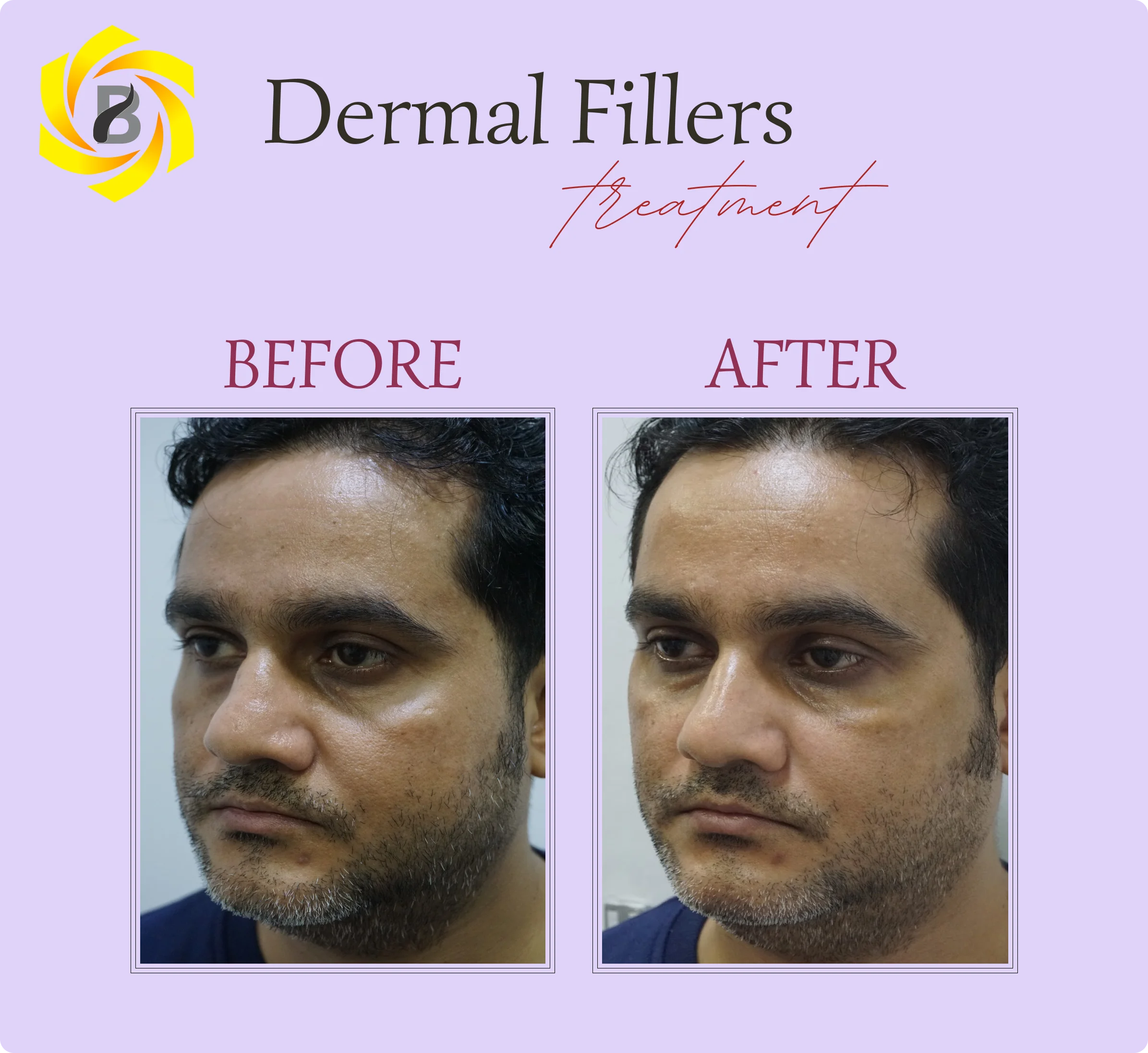 Before & After Result 1