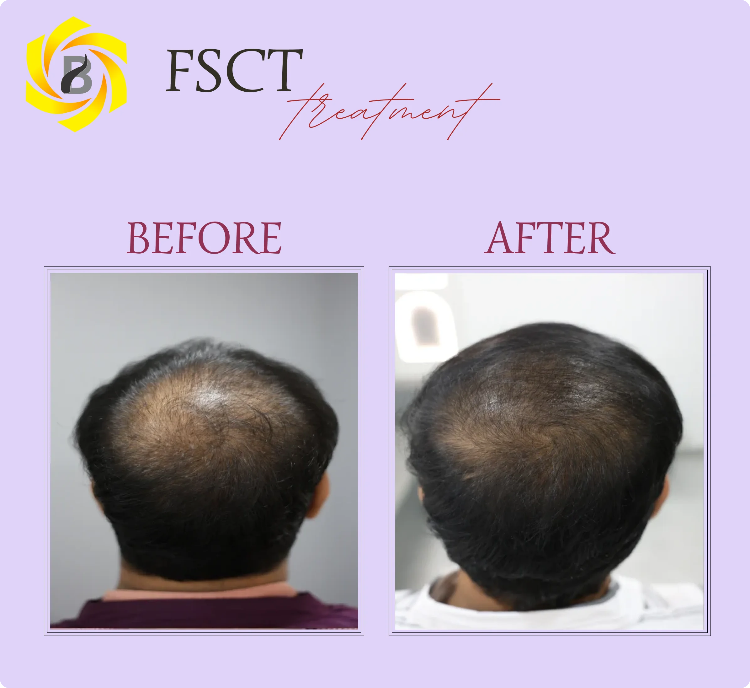 Before & After Result 1