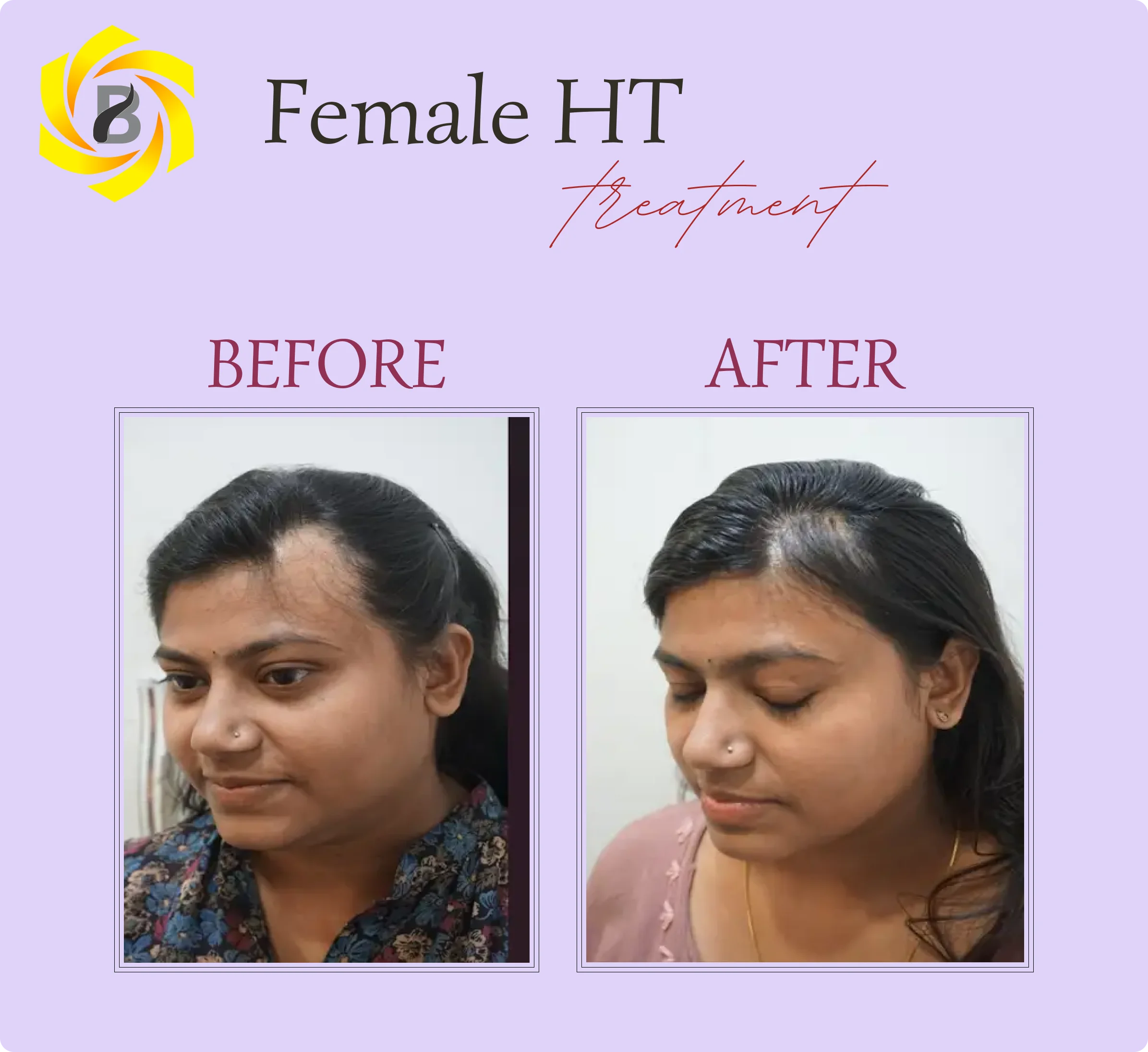 Before & After Result