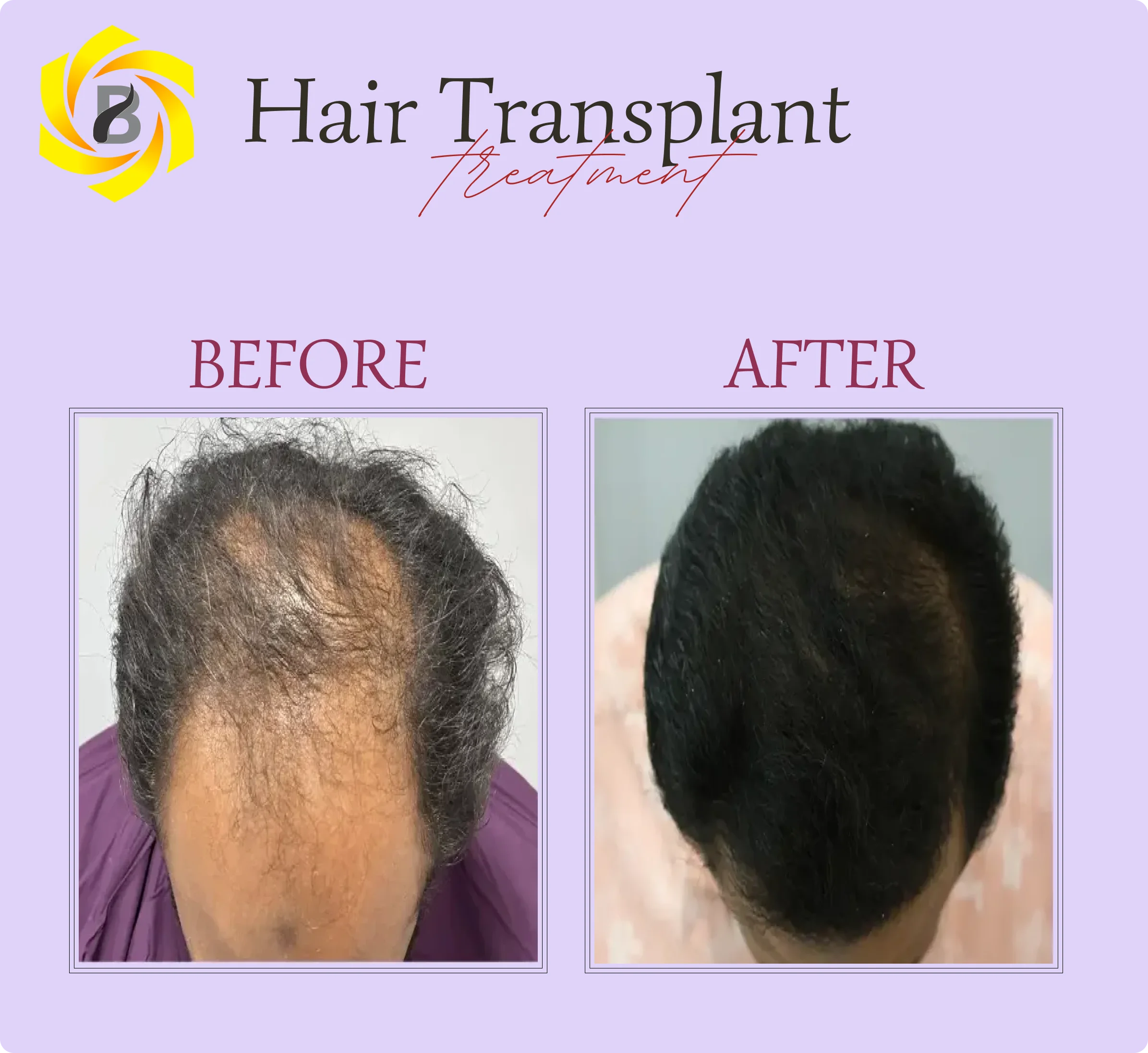Before & After Result 1