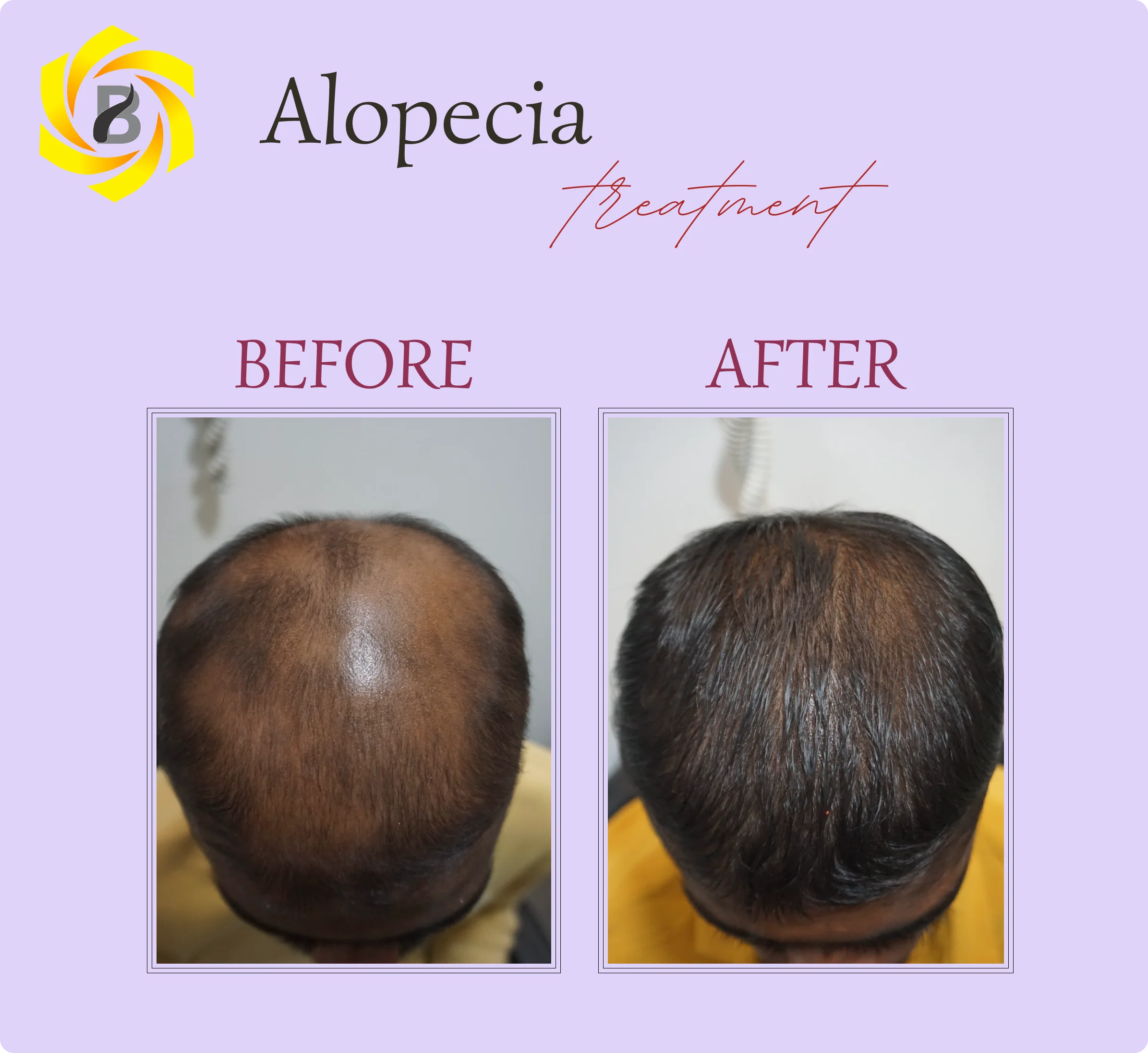 Before & After Result