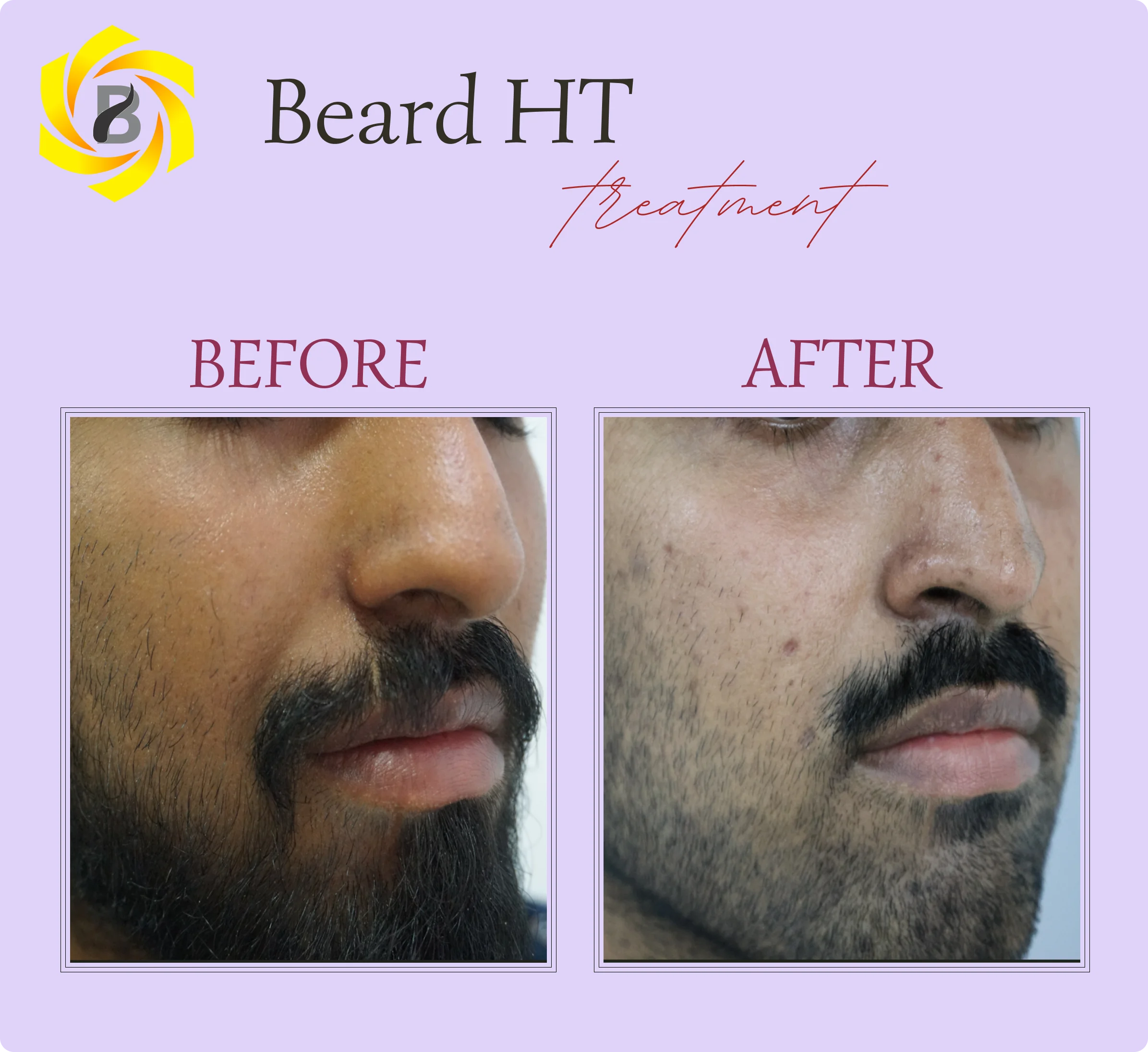 Before & After Result
