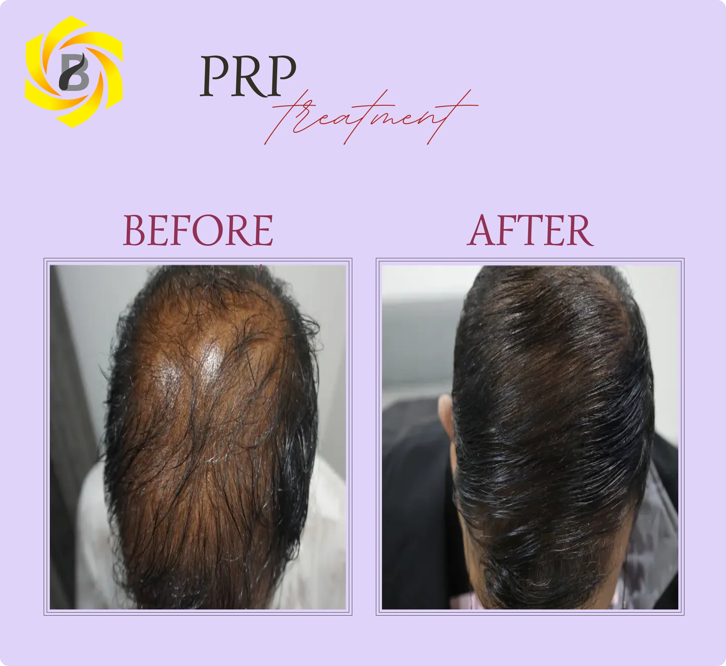 Before & After Result 1