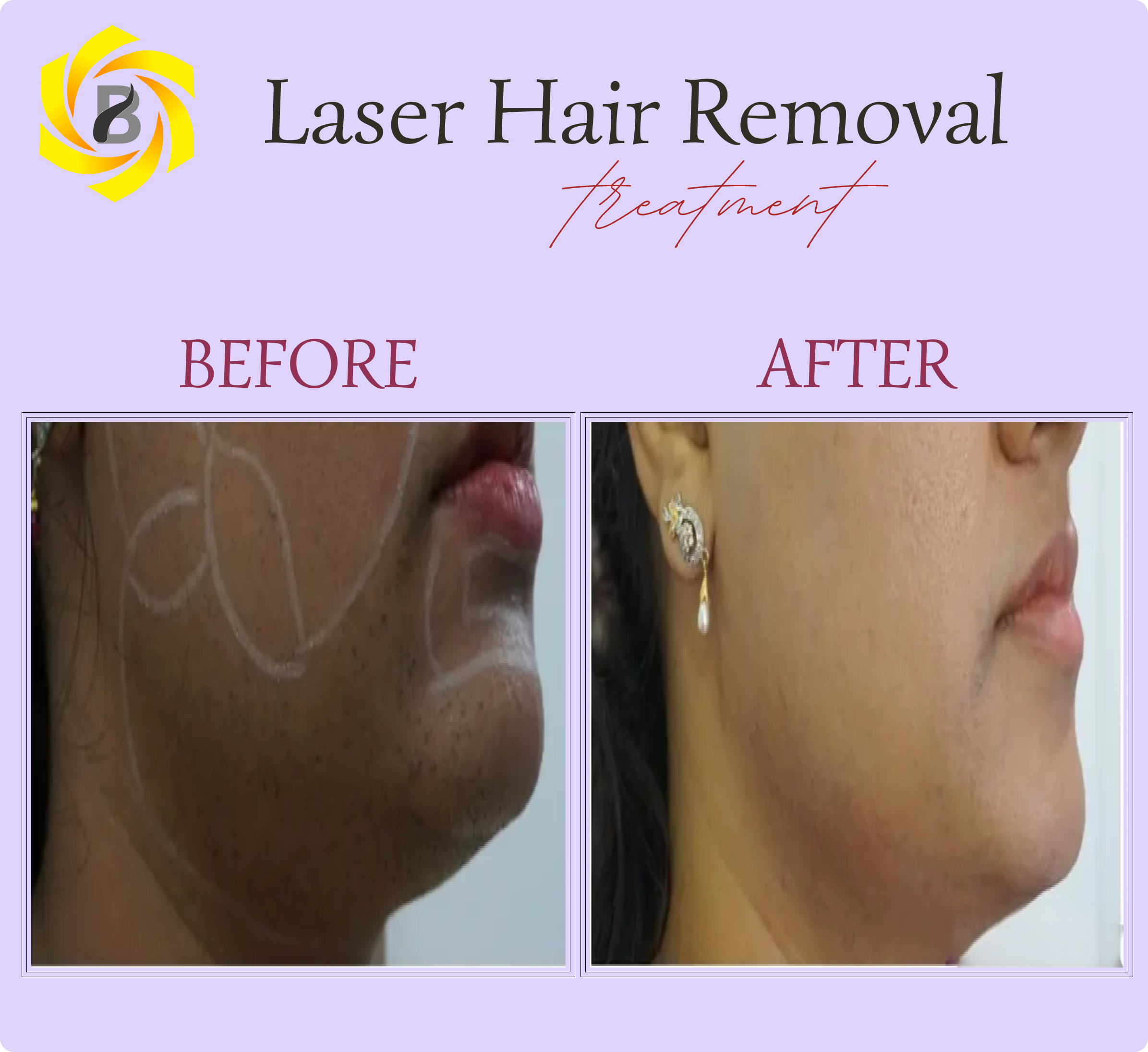 Before & After Result 1