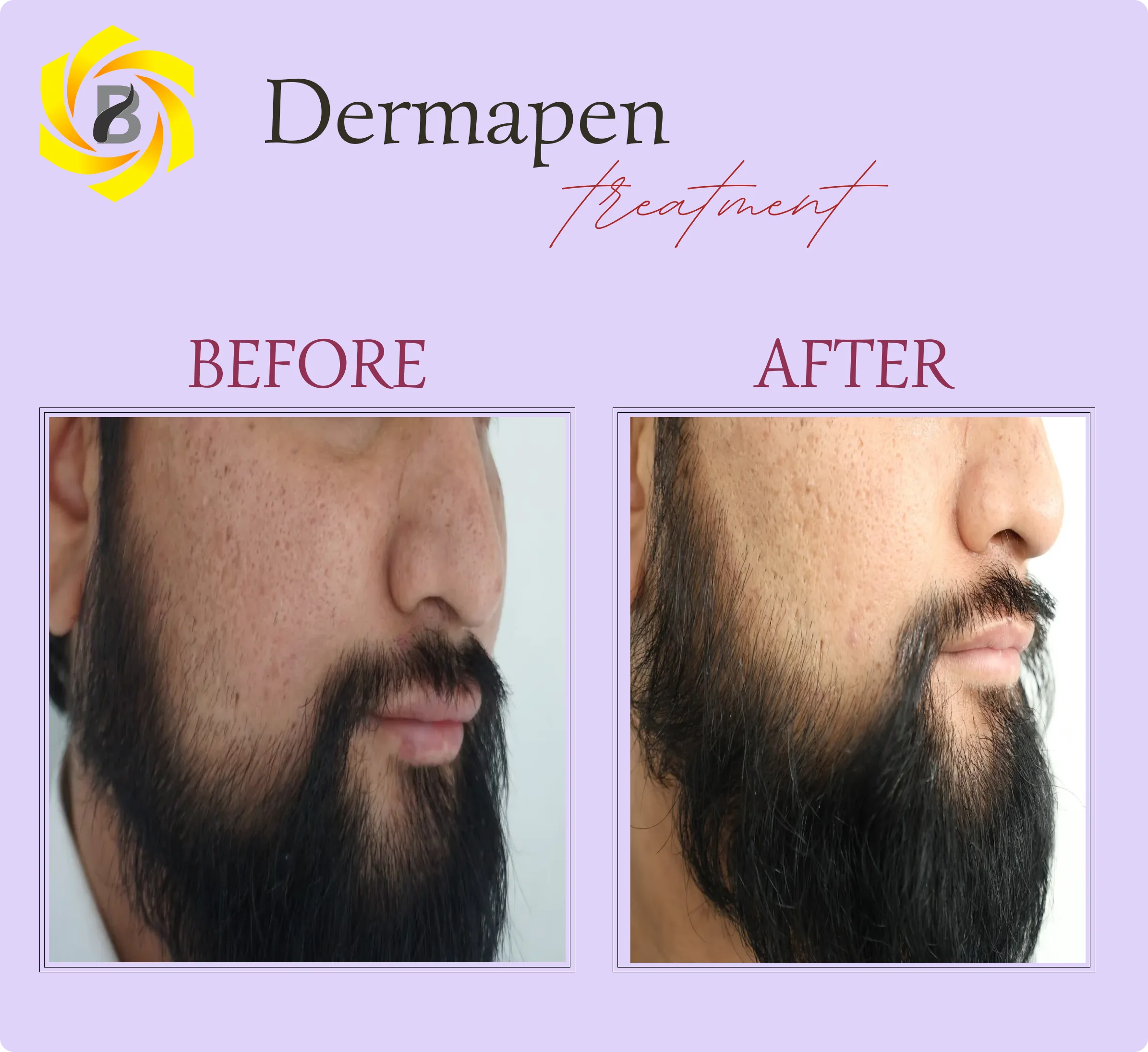 Before & After Result