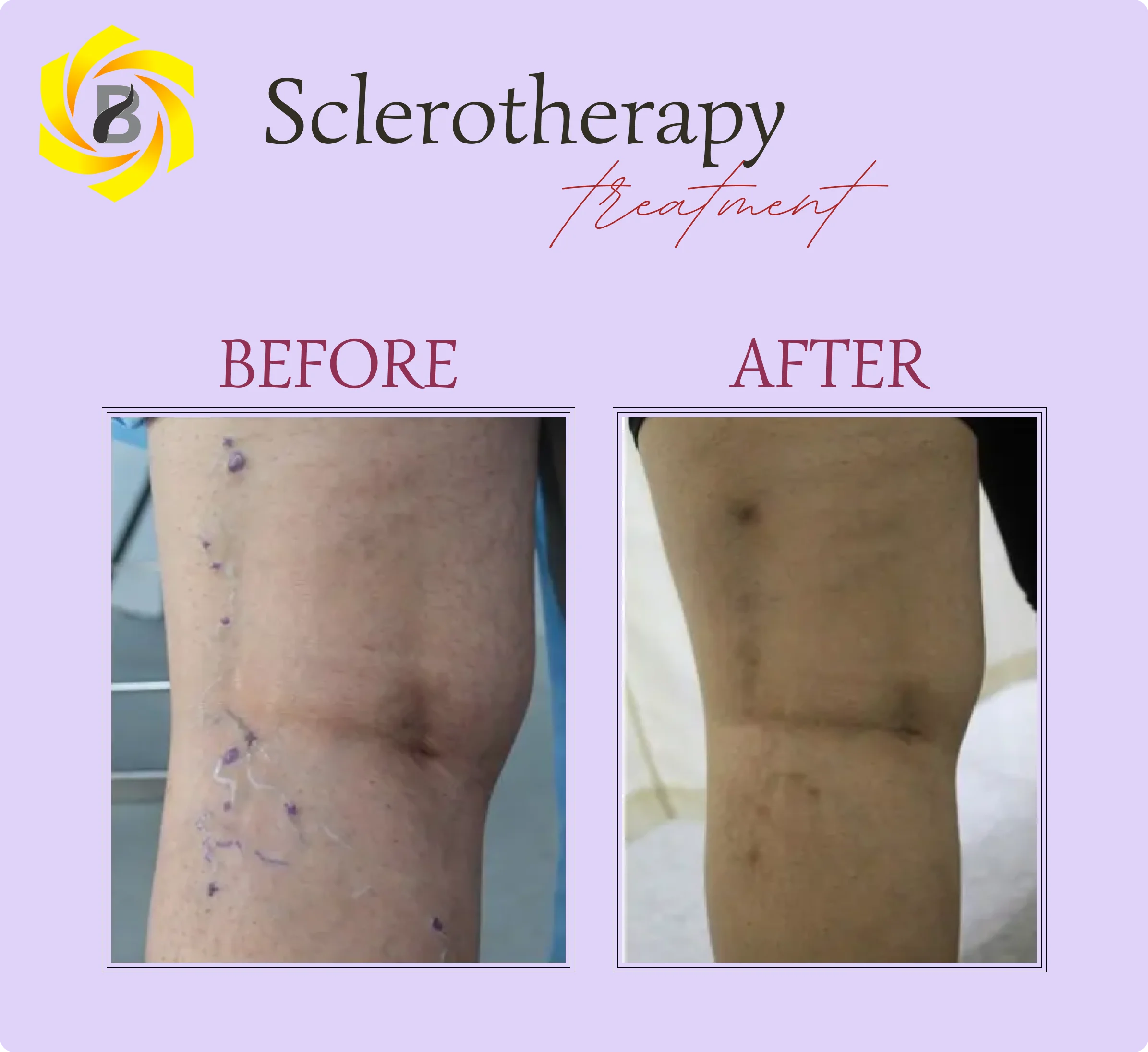 Before & After Result