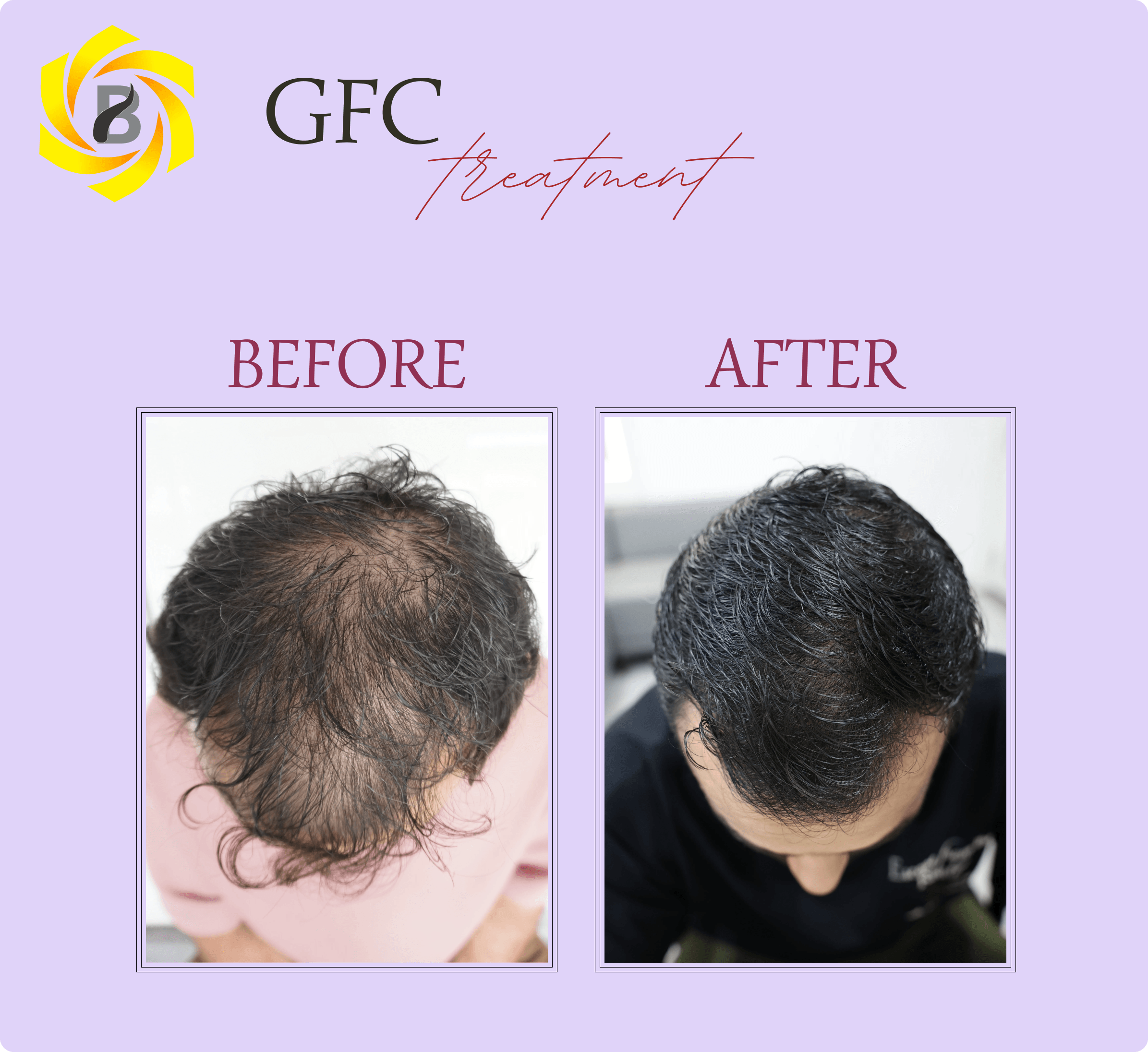 Before & After Result 7