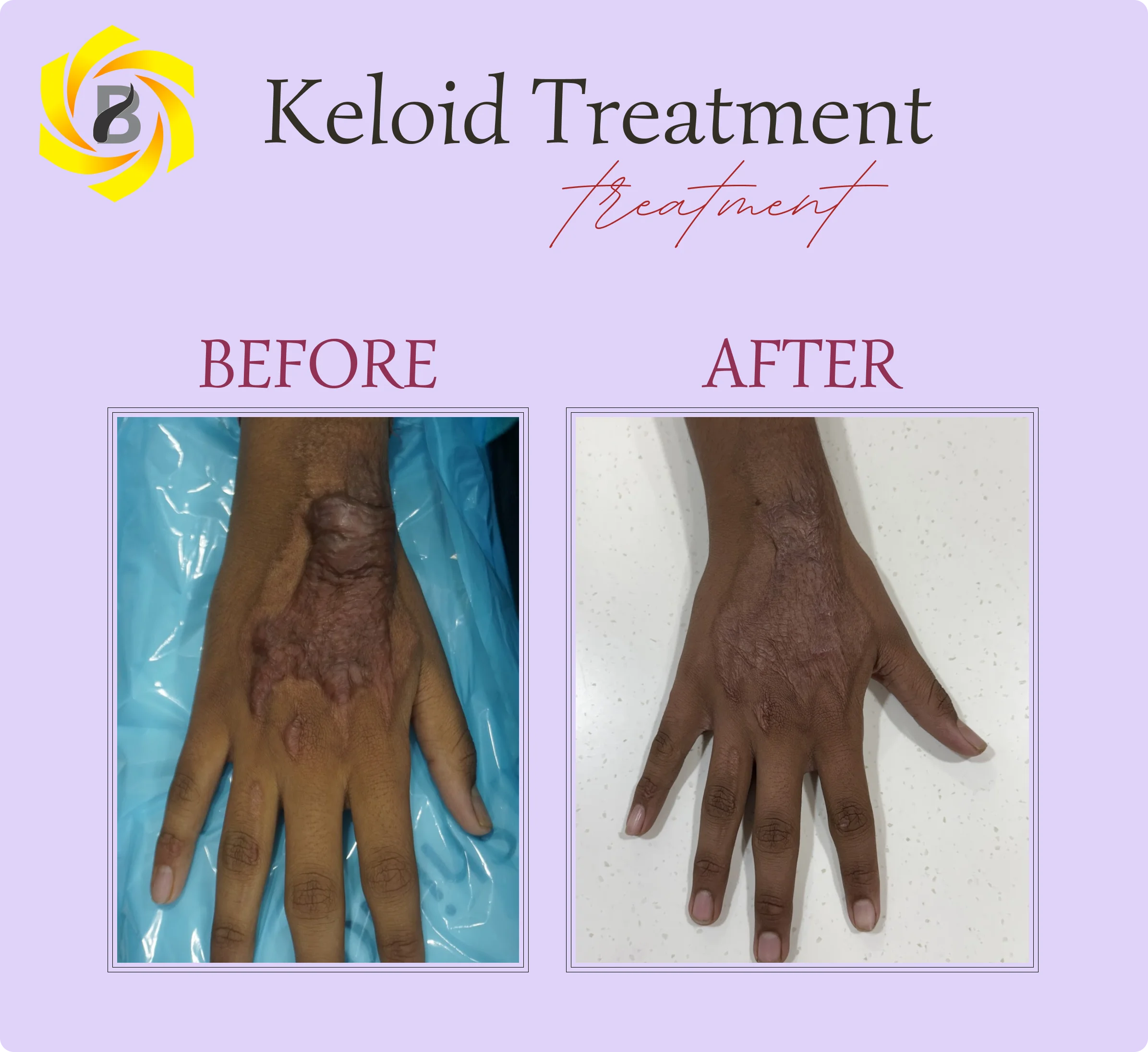 Before & After Result