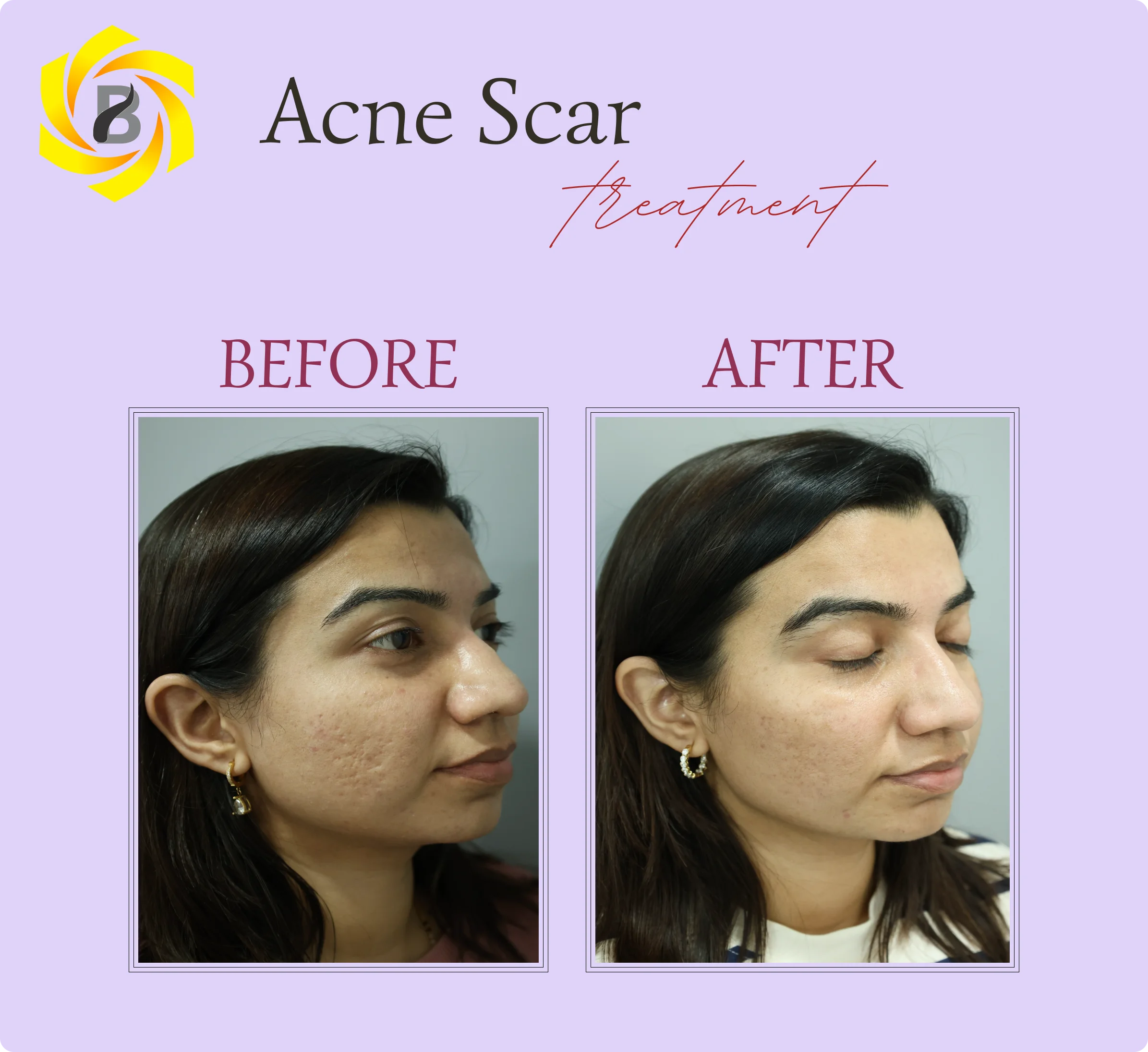 Before & After Result 1