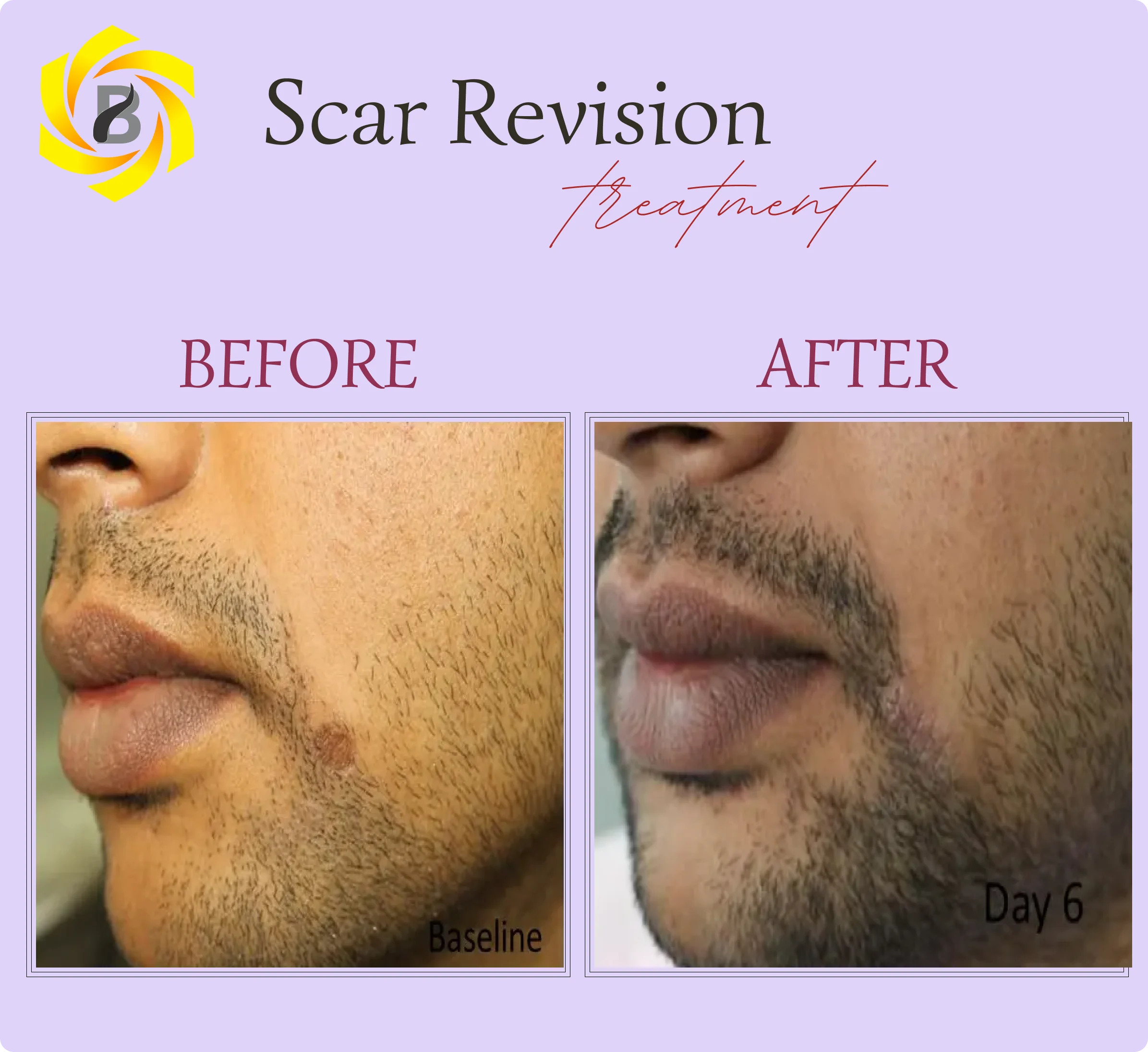 Before & After Result