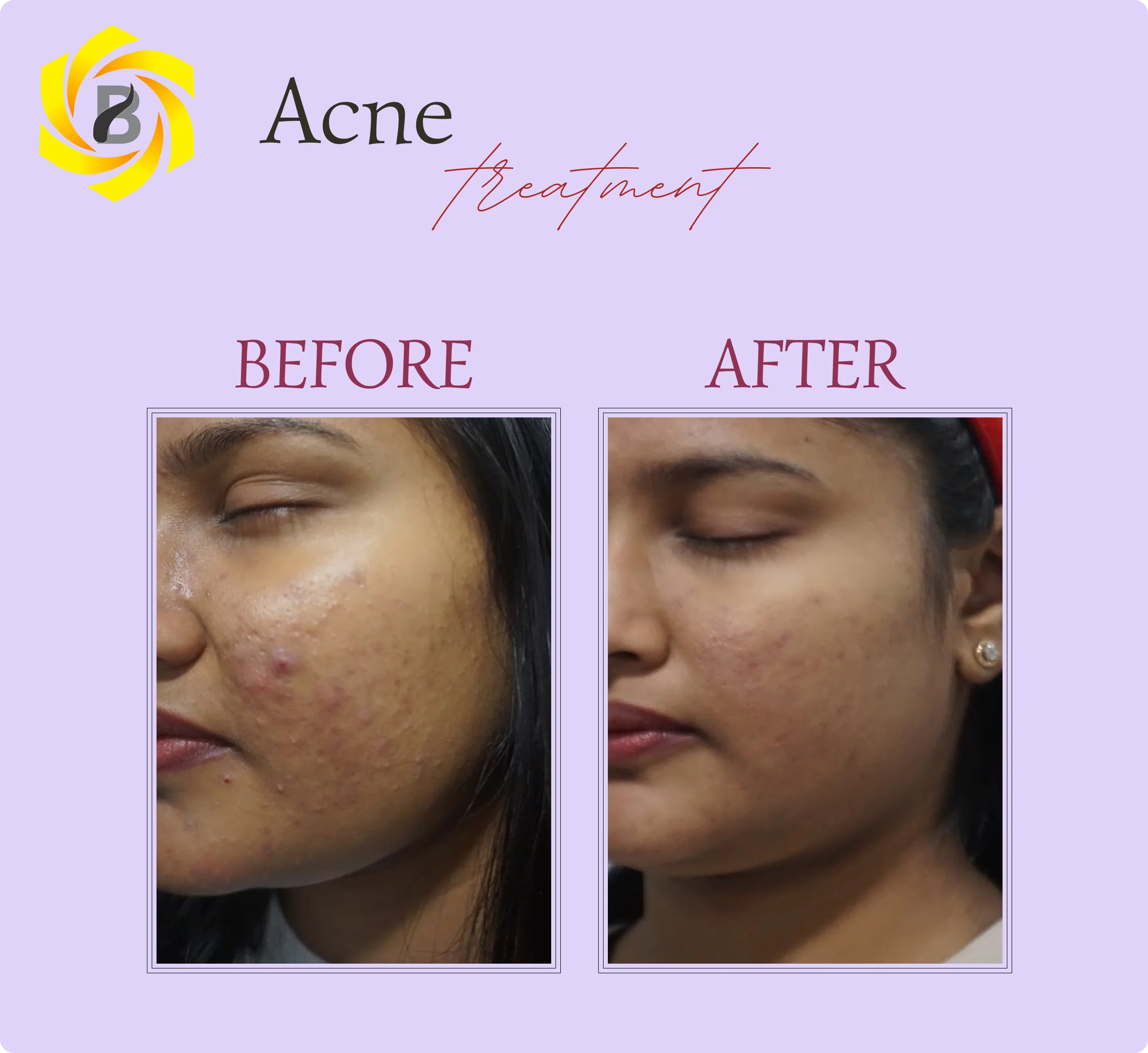 Before & After Result