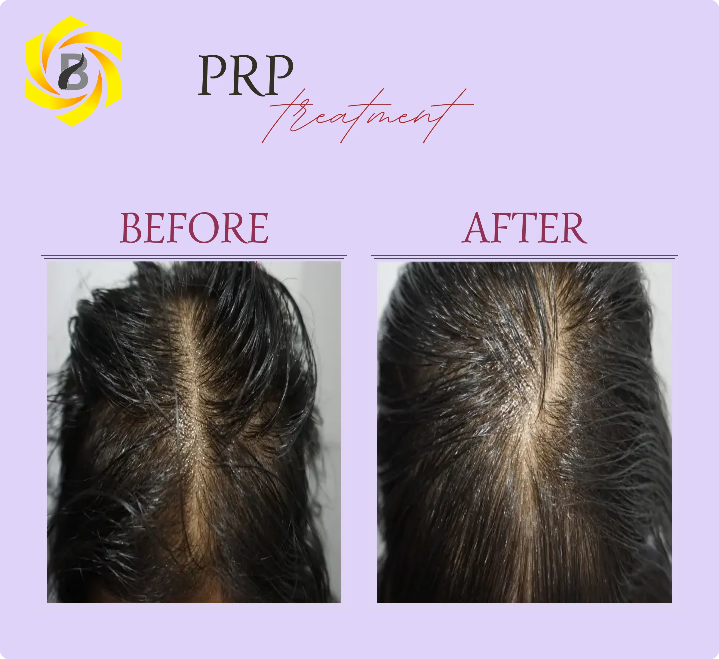Before & After Result 2