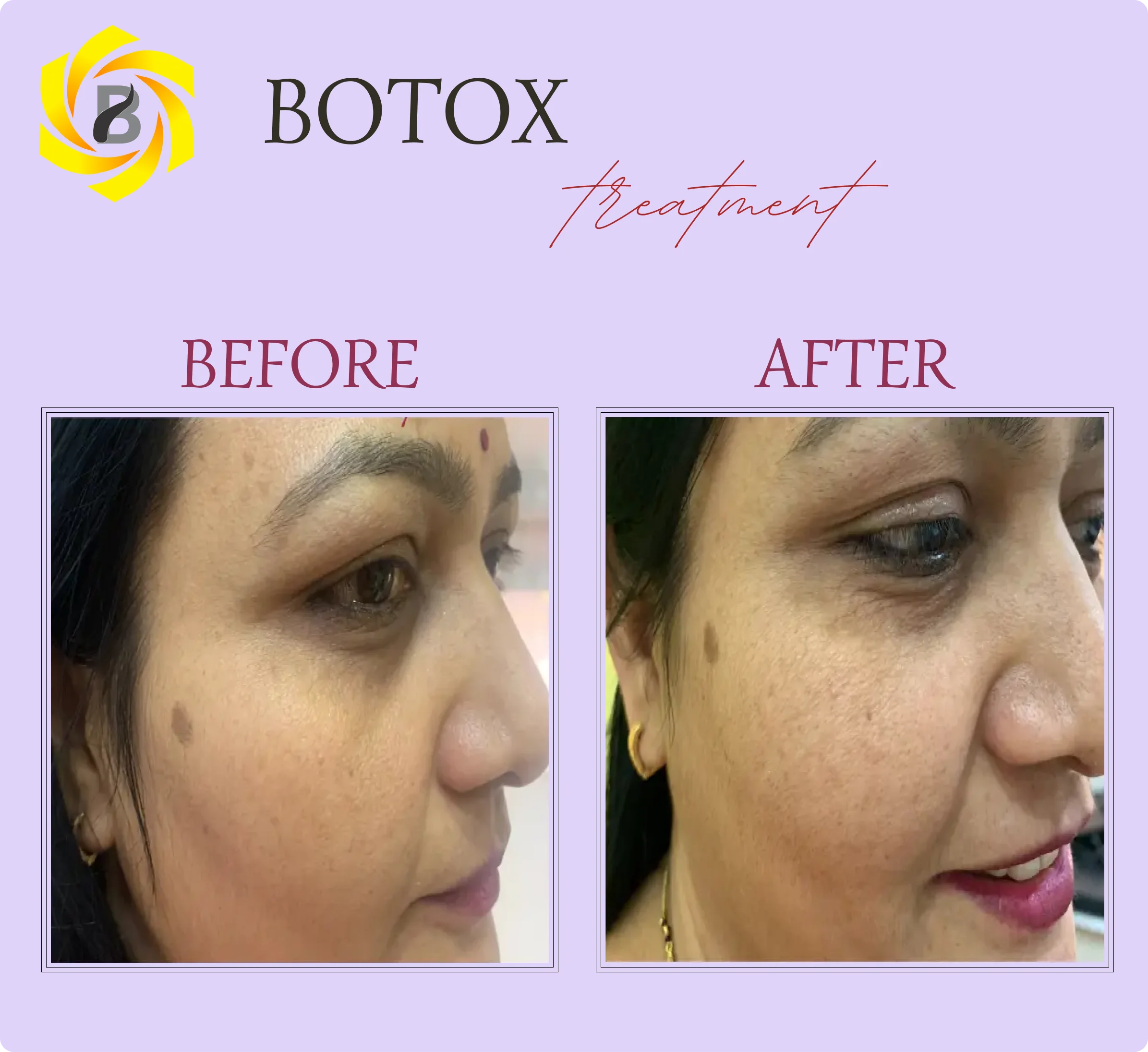 Before & After Result 2