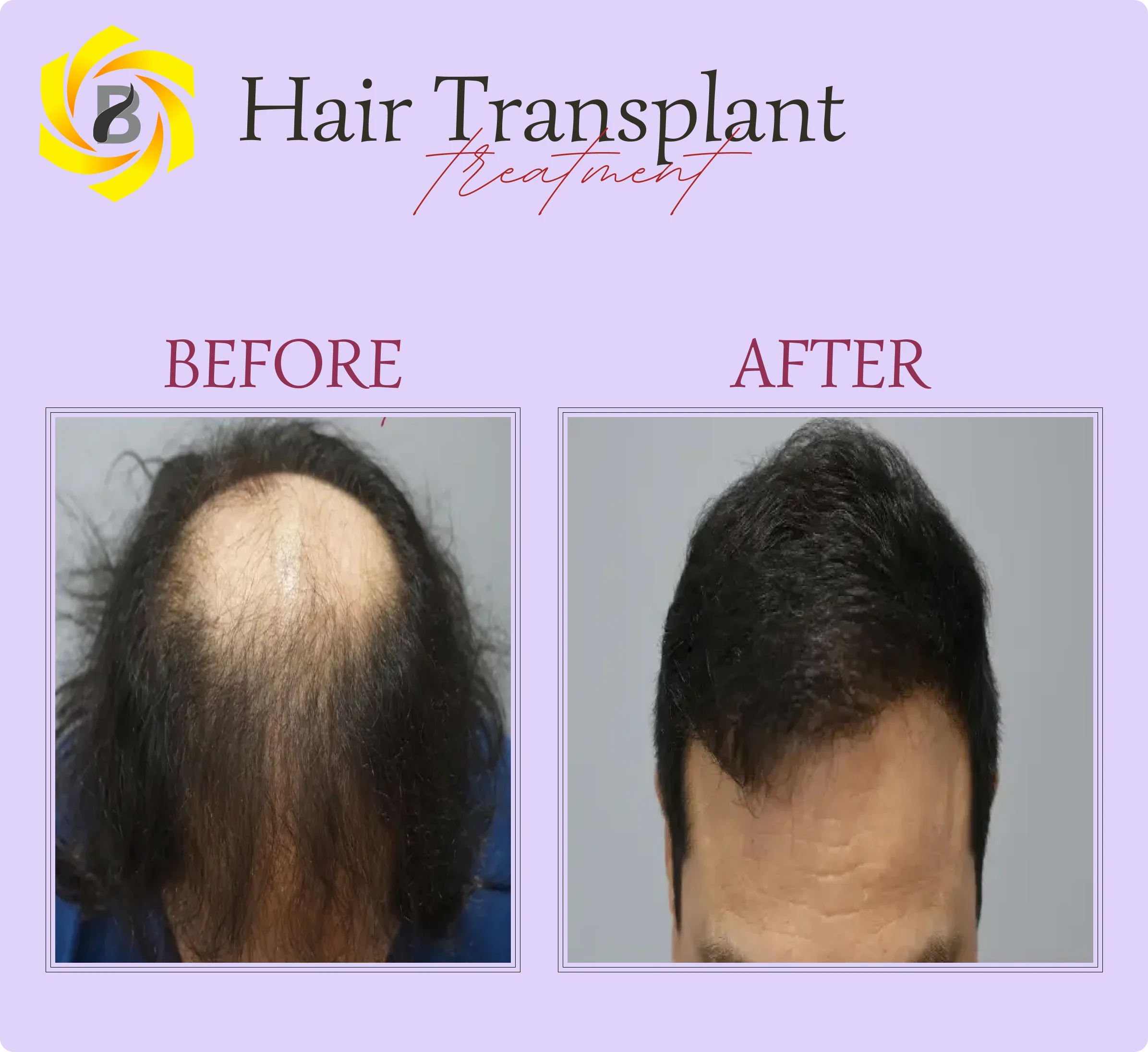 Before & After Result 2