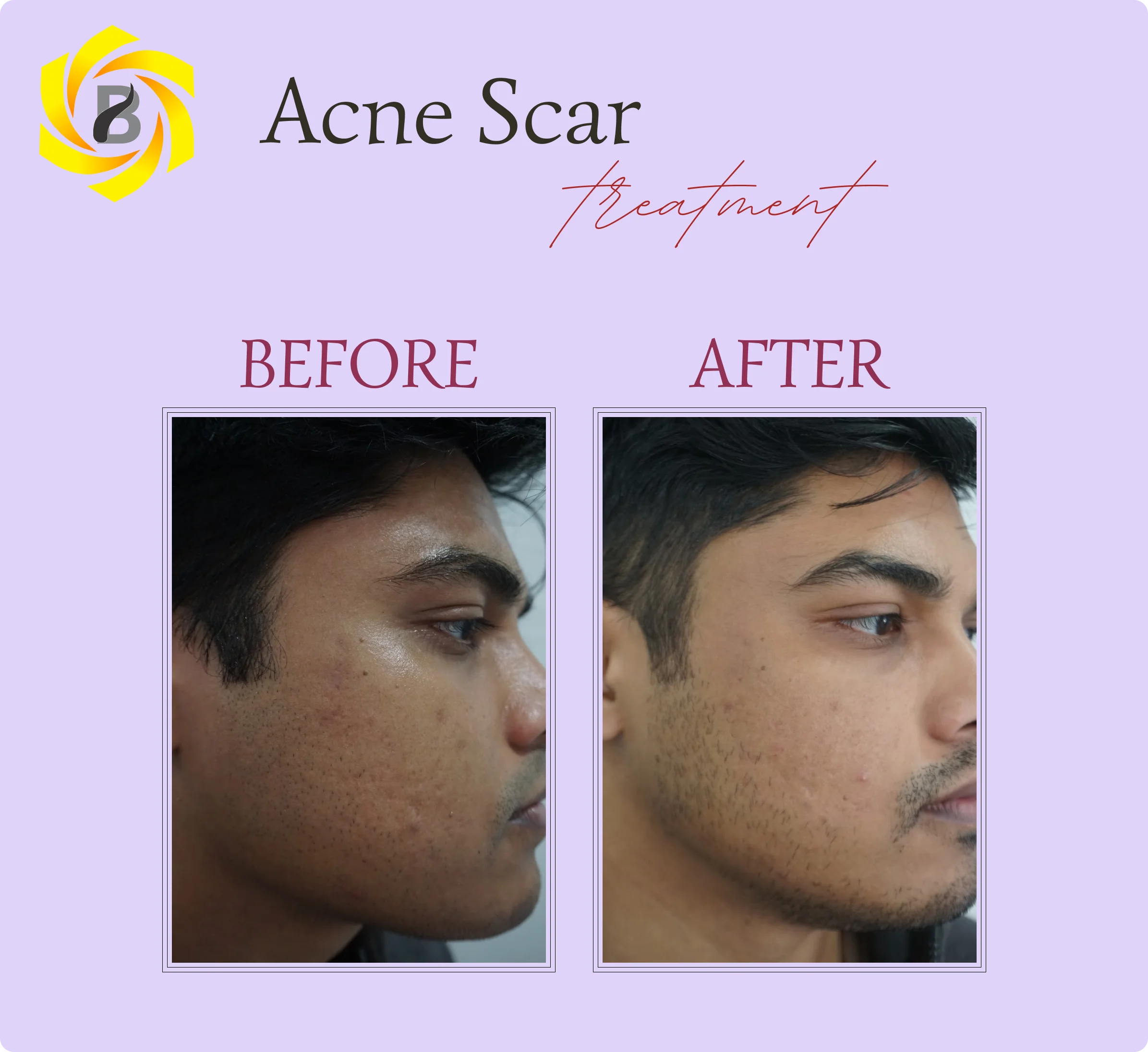 Before & After Result 2