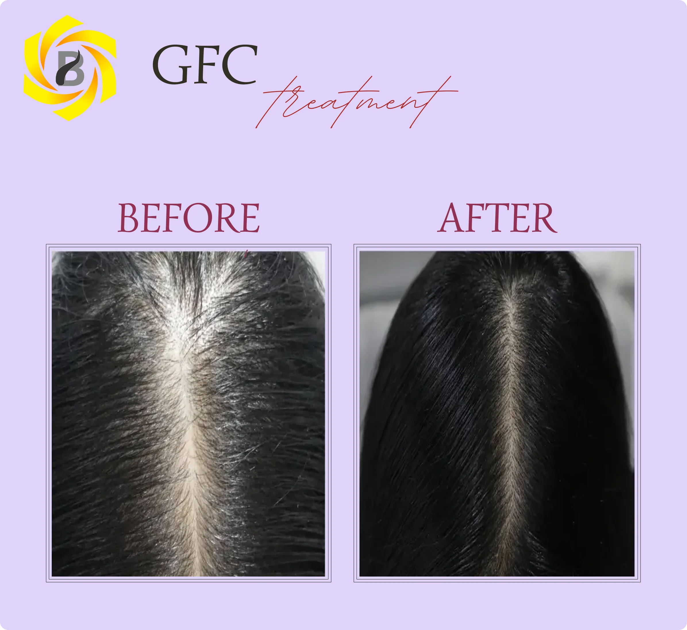 Before & After Result 2