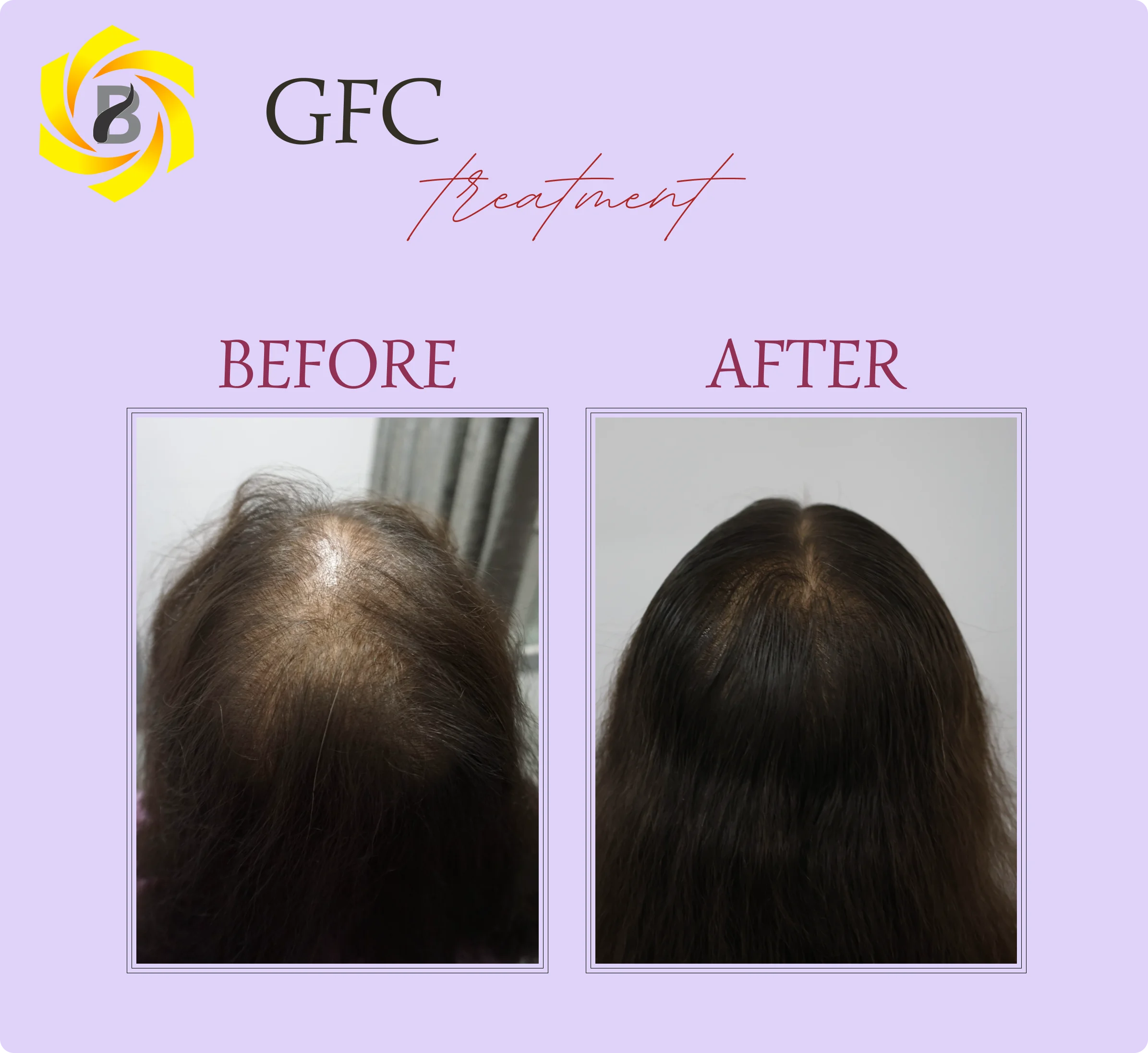 Before & After Result 8