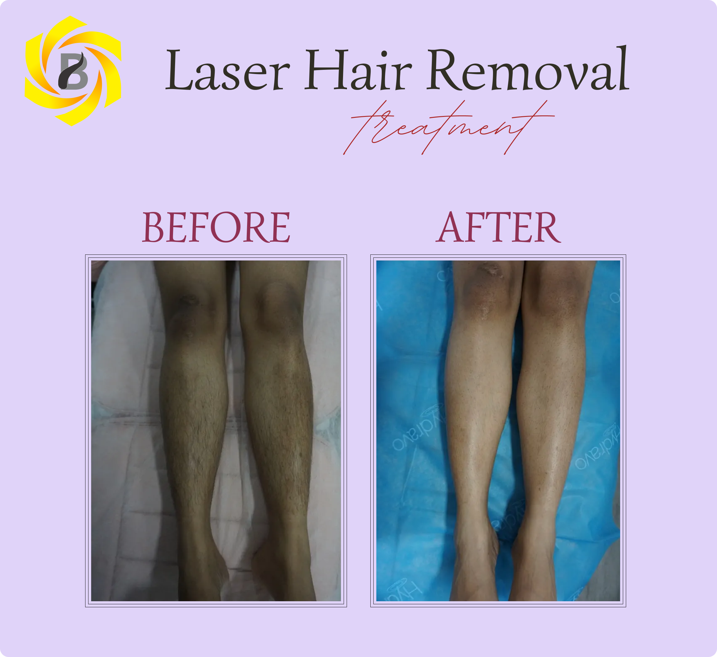 Before & After Result 2