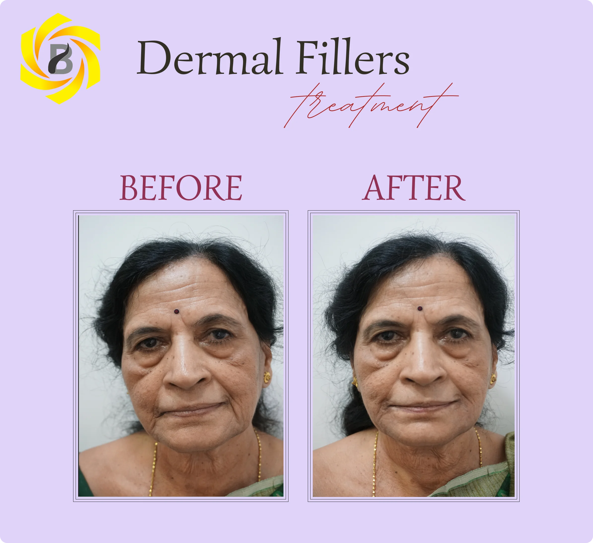 Before & After Result 2