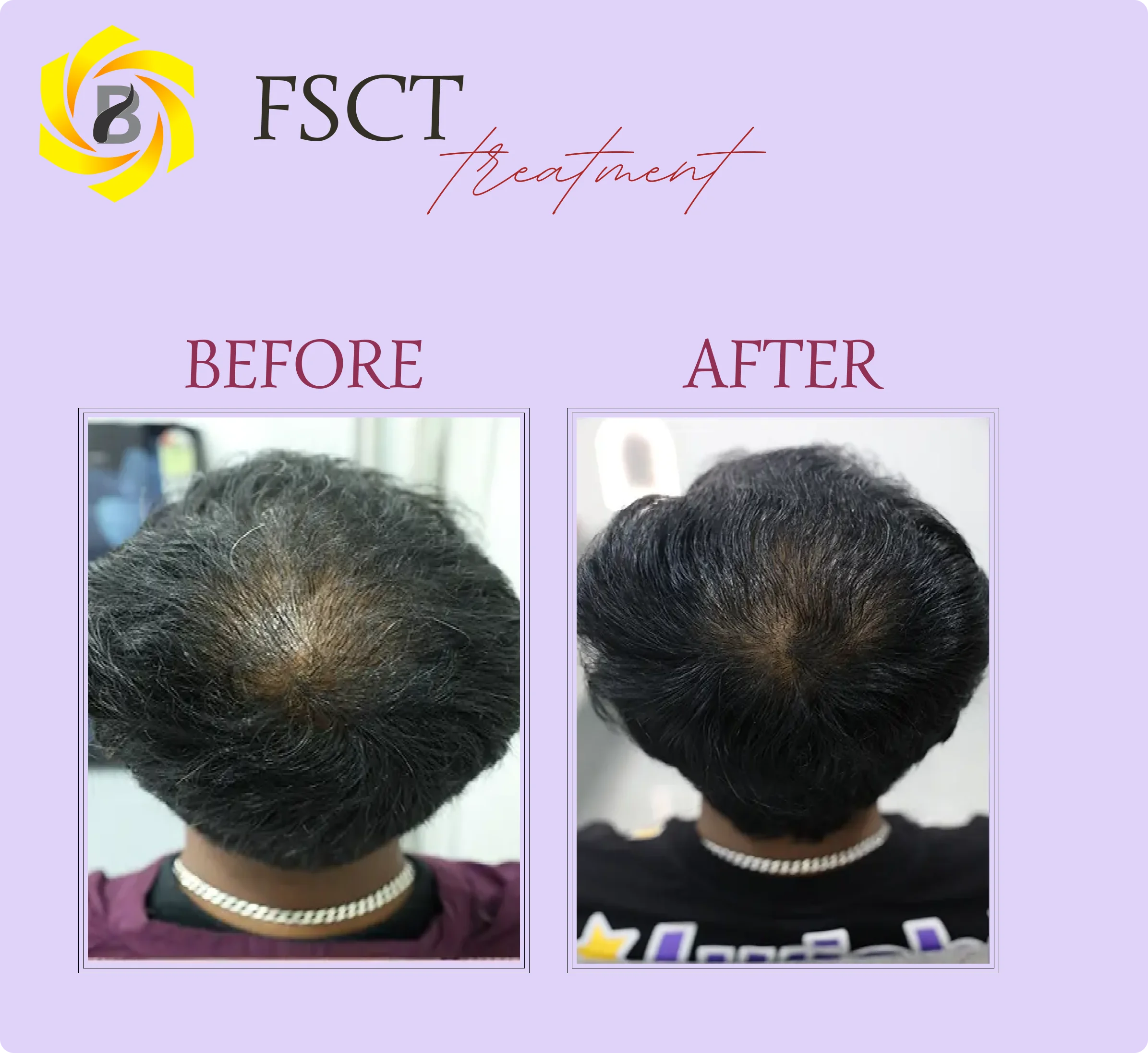 Before & After Result 2
