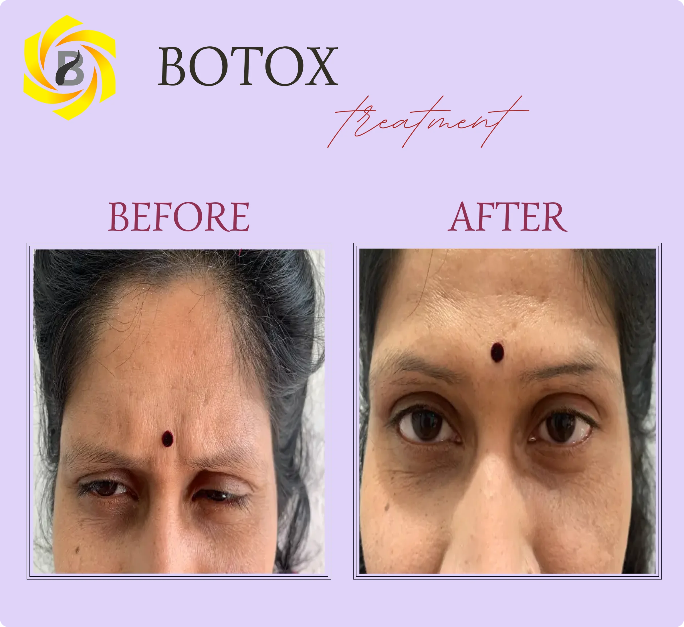 Before & After Result 3