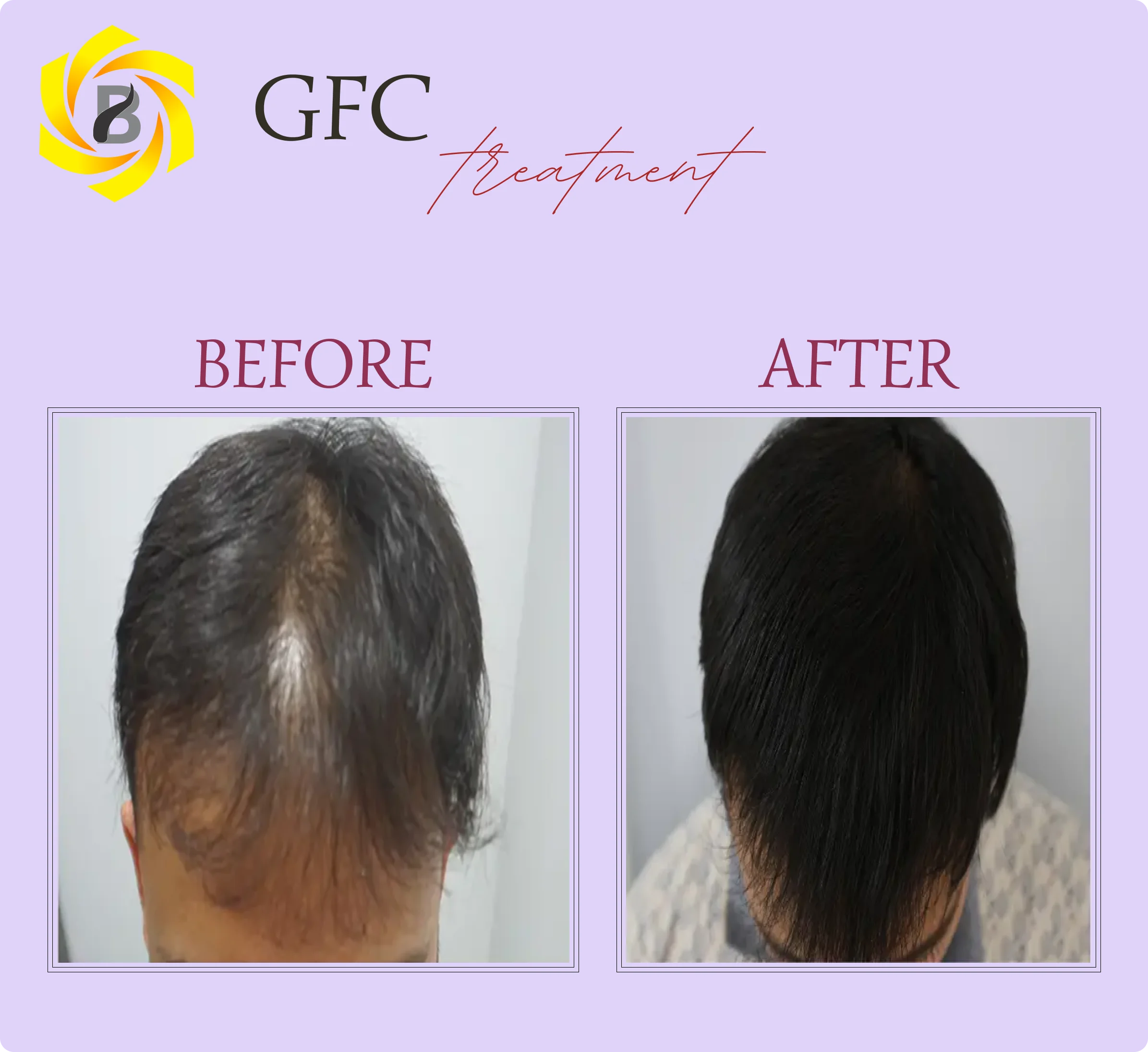 Before & After Result 3
