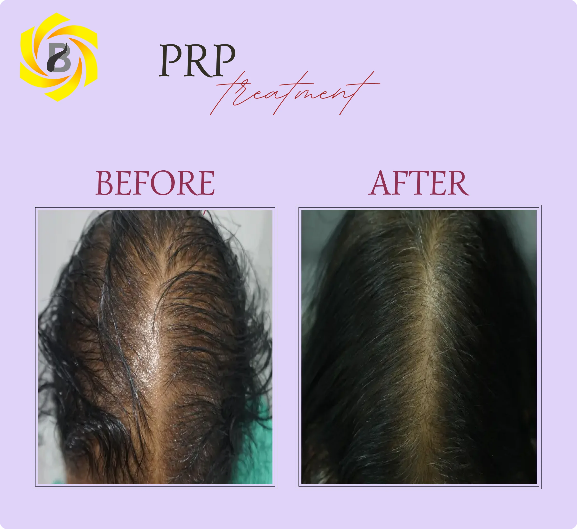 Before & After Result 3
