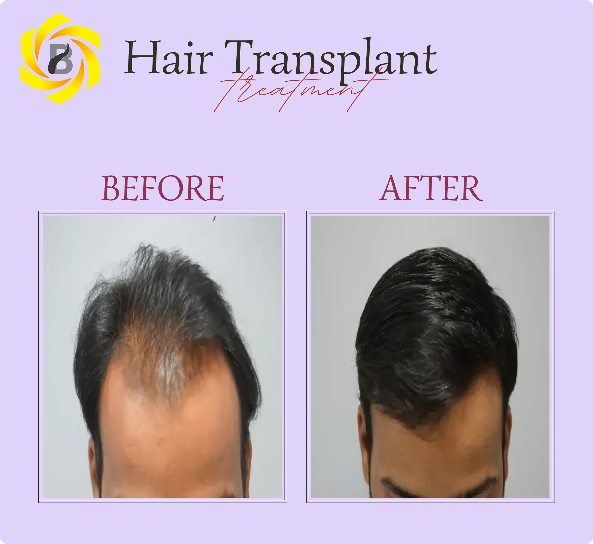 Before & After Result 3