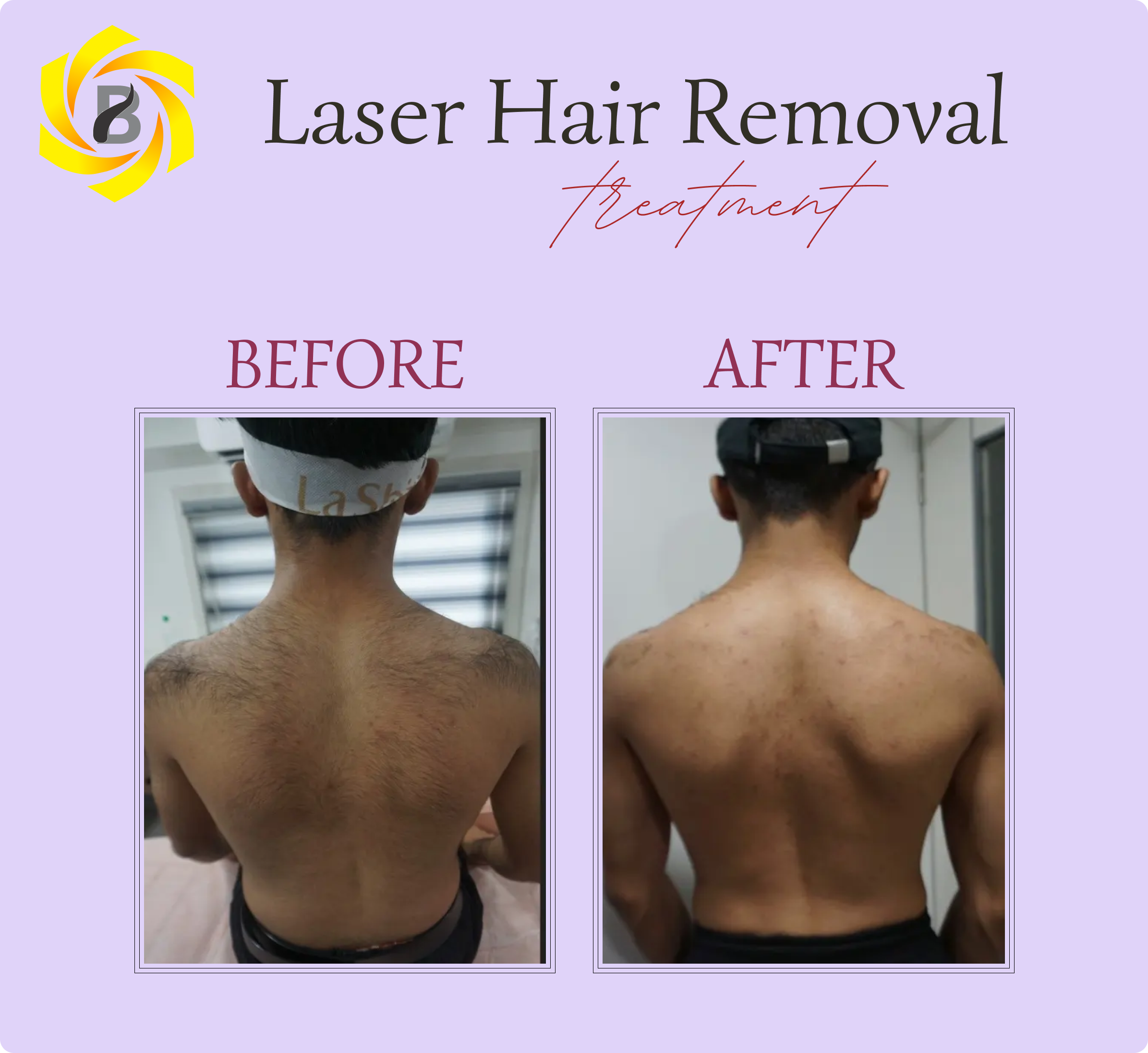 Before & After Result 3
