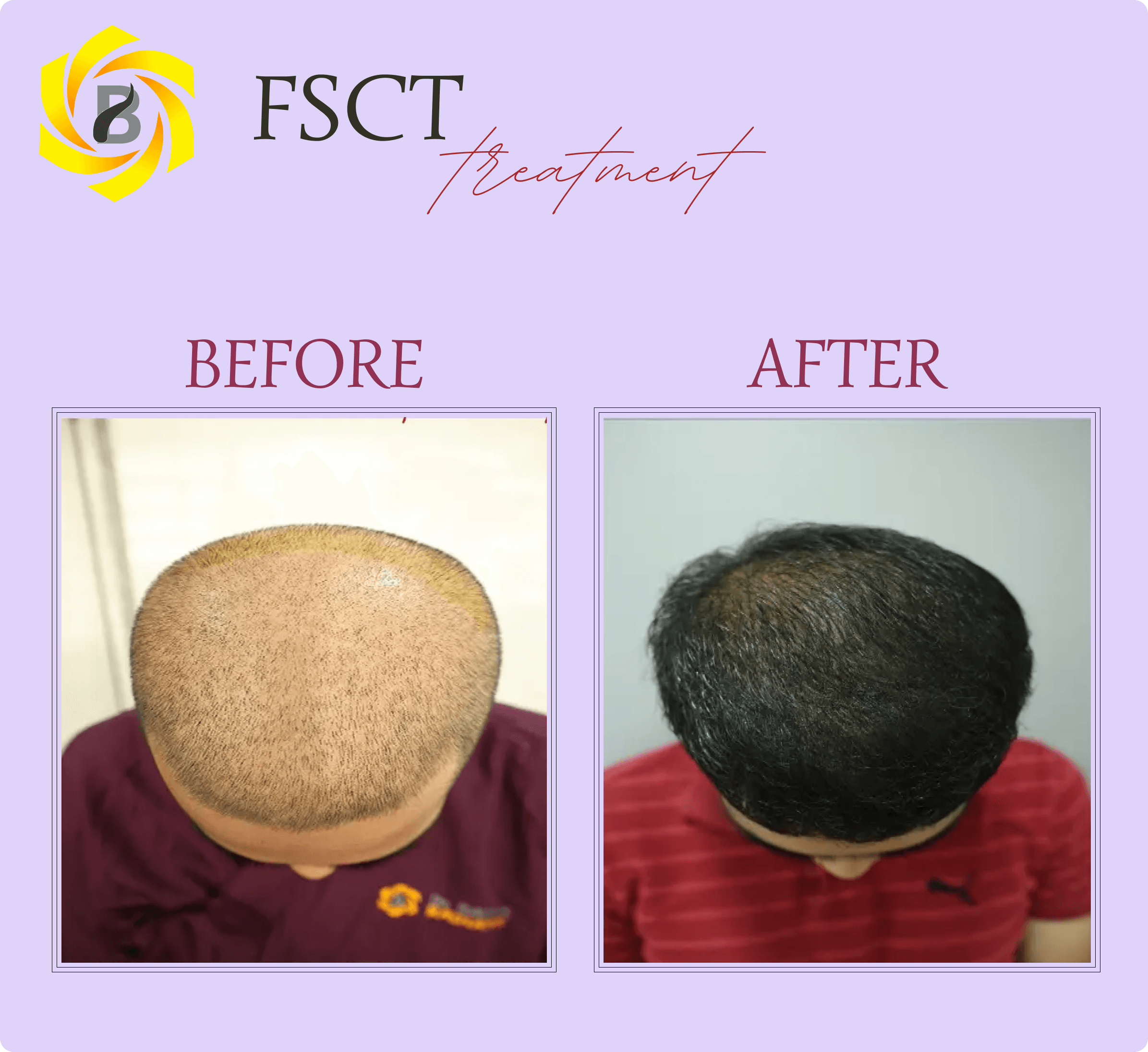 Before & After Result 3