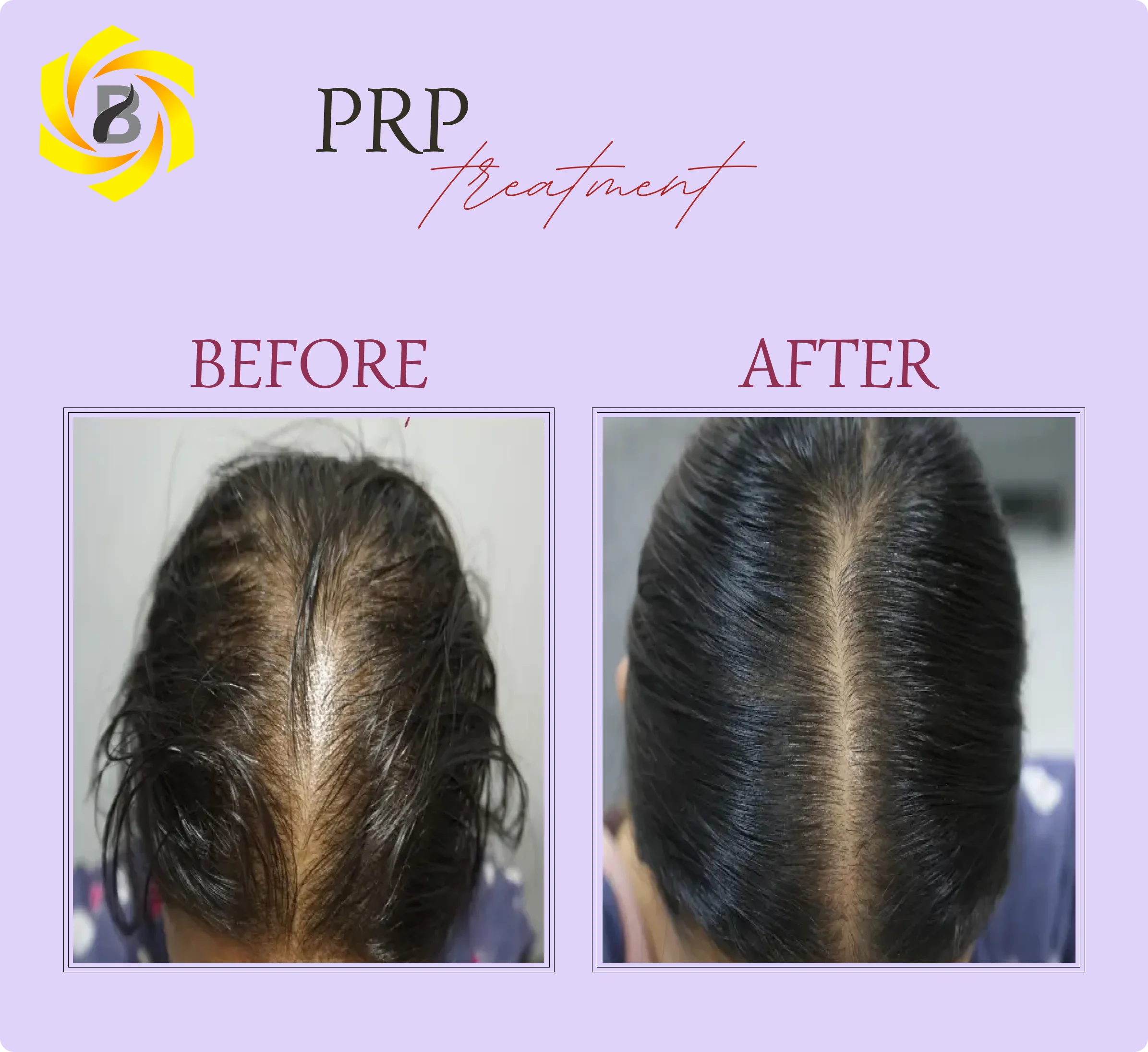 Before & After Result 4
