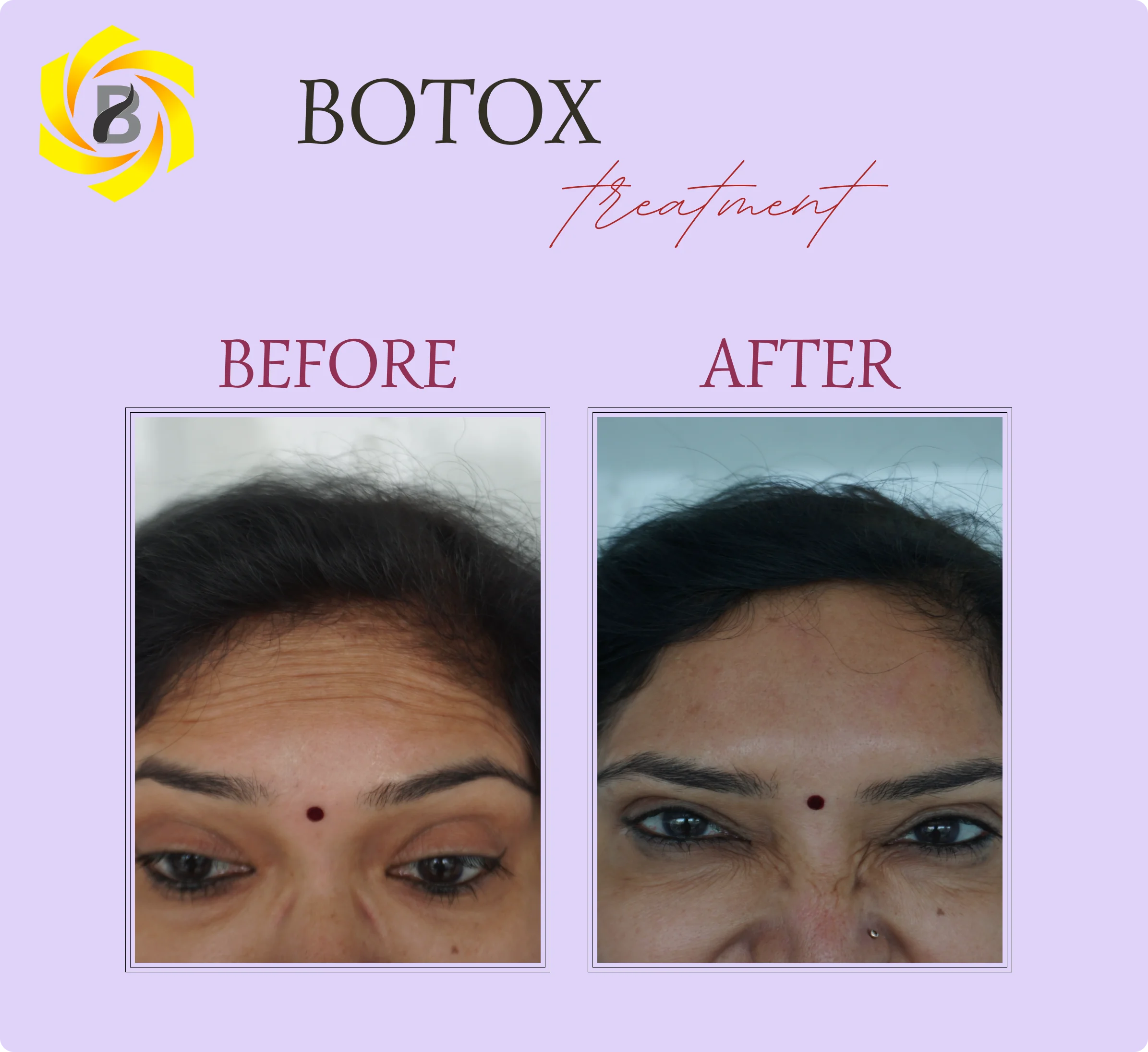 Before & After Result 4