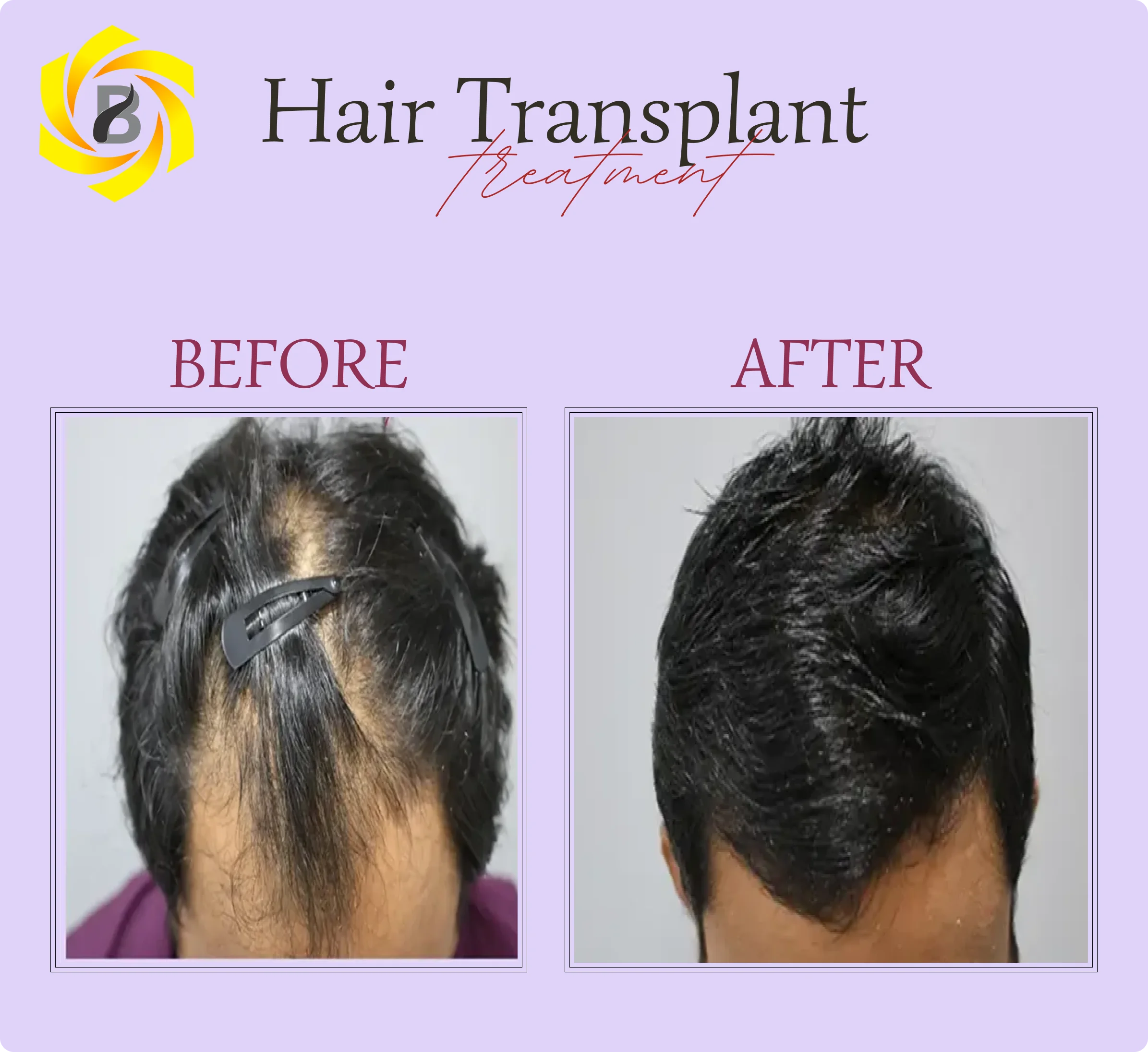 Before & After Result 4
