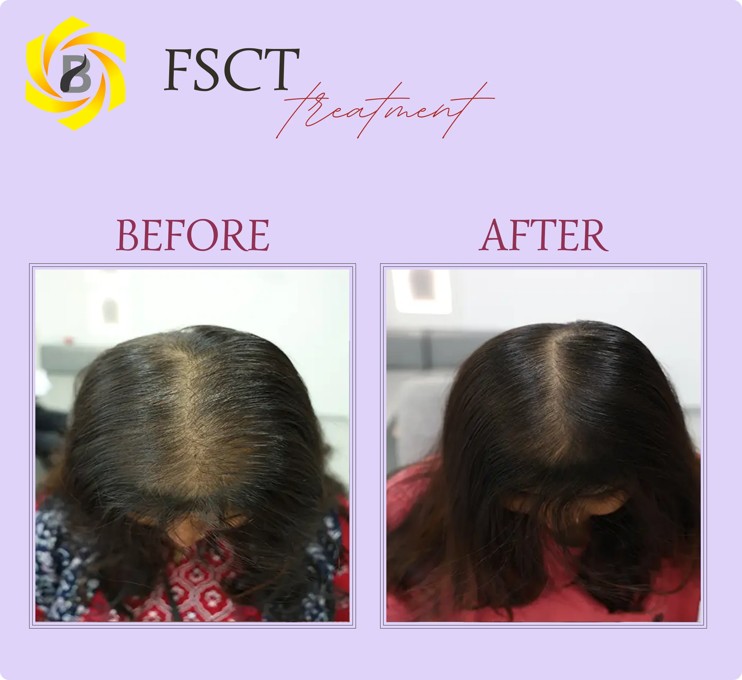 Before & After Result 4