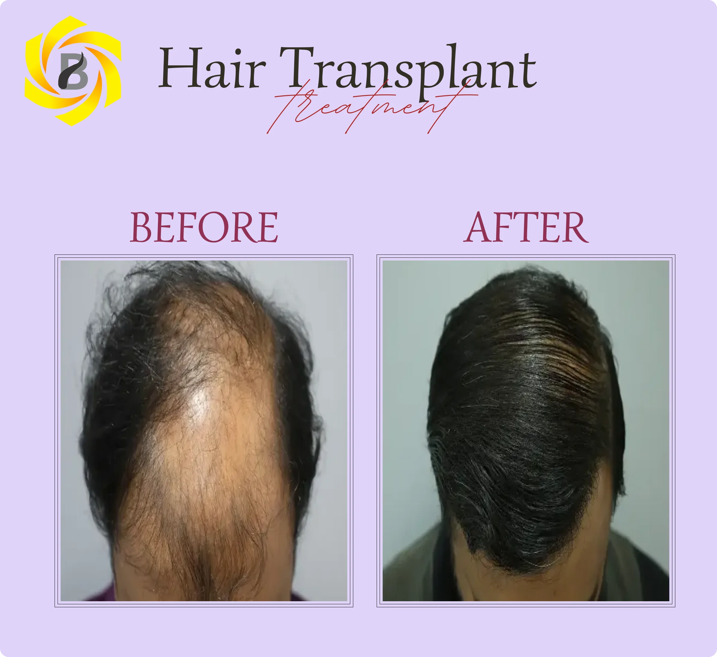 Before & After Result 5