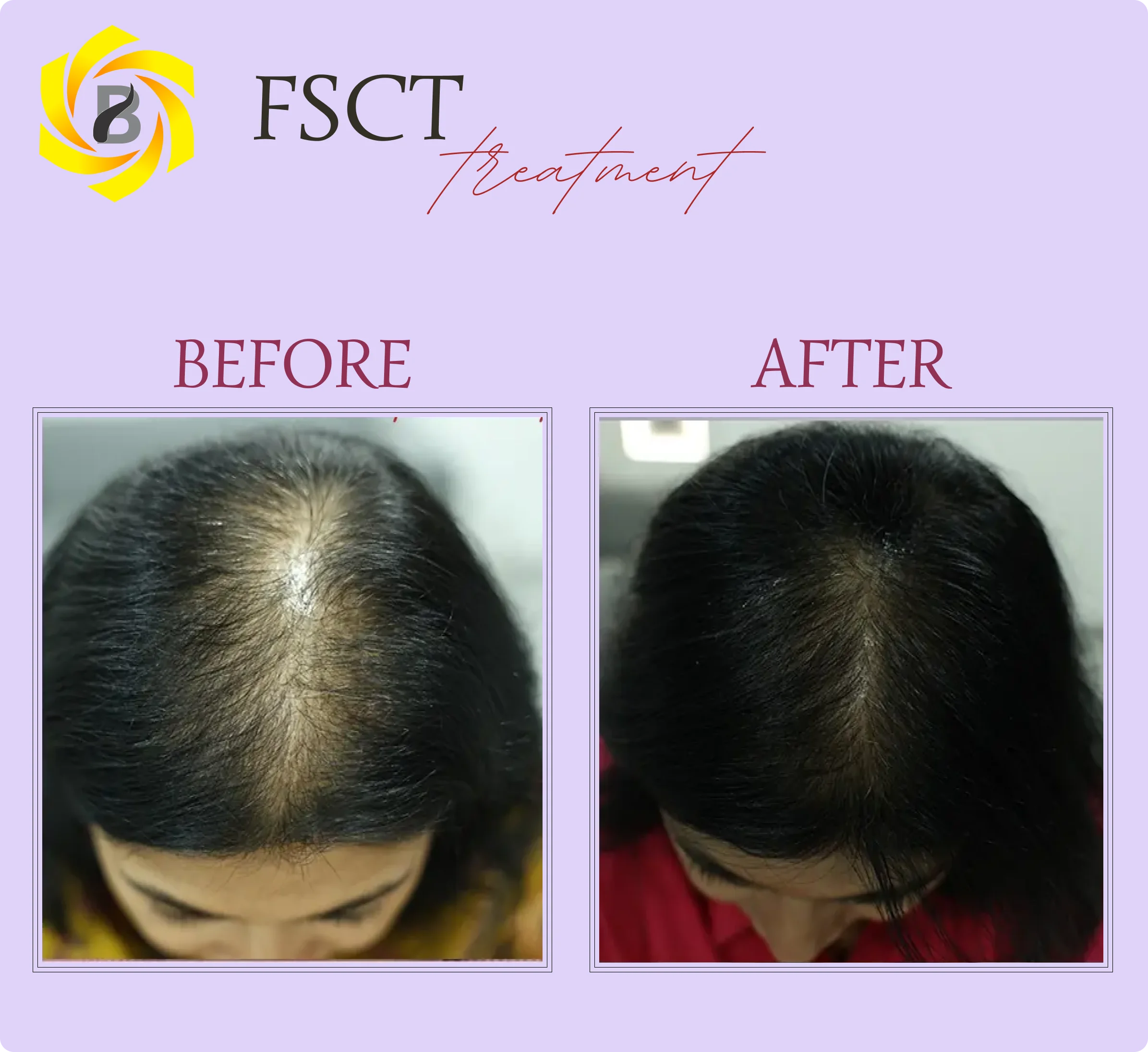 Before & After Result 5