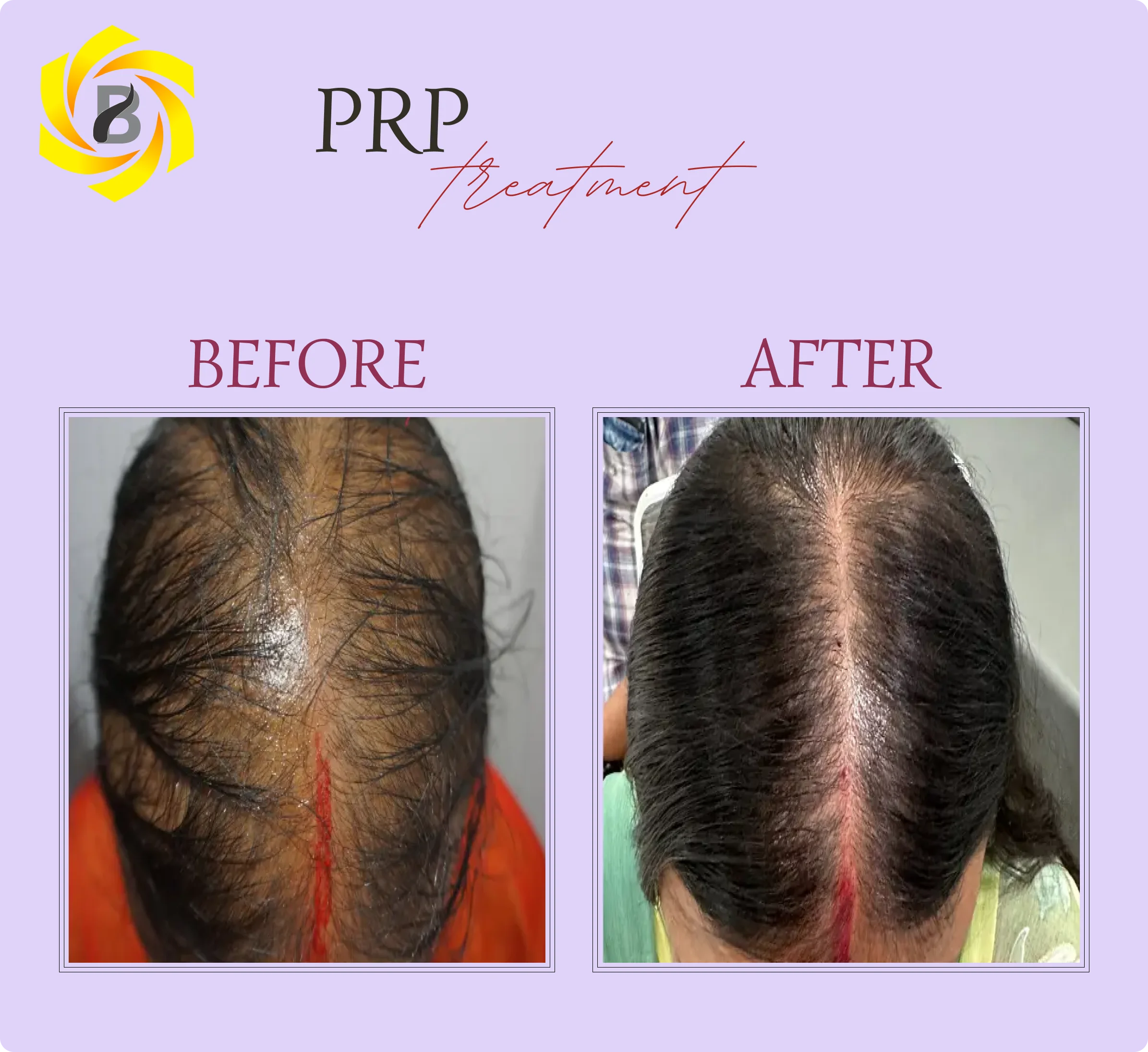Before & After Result 5