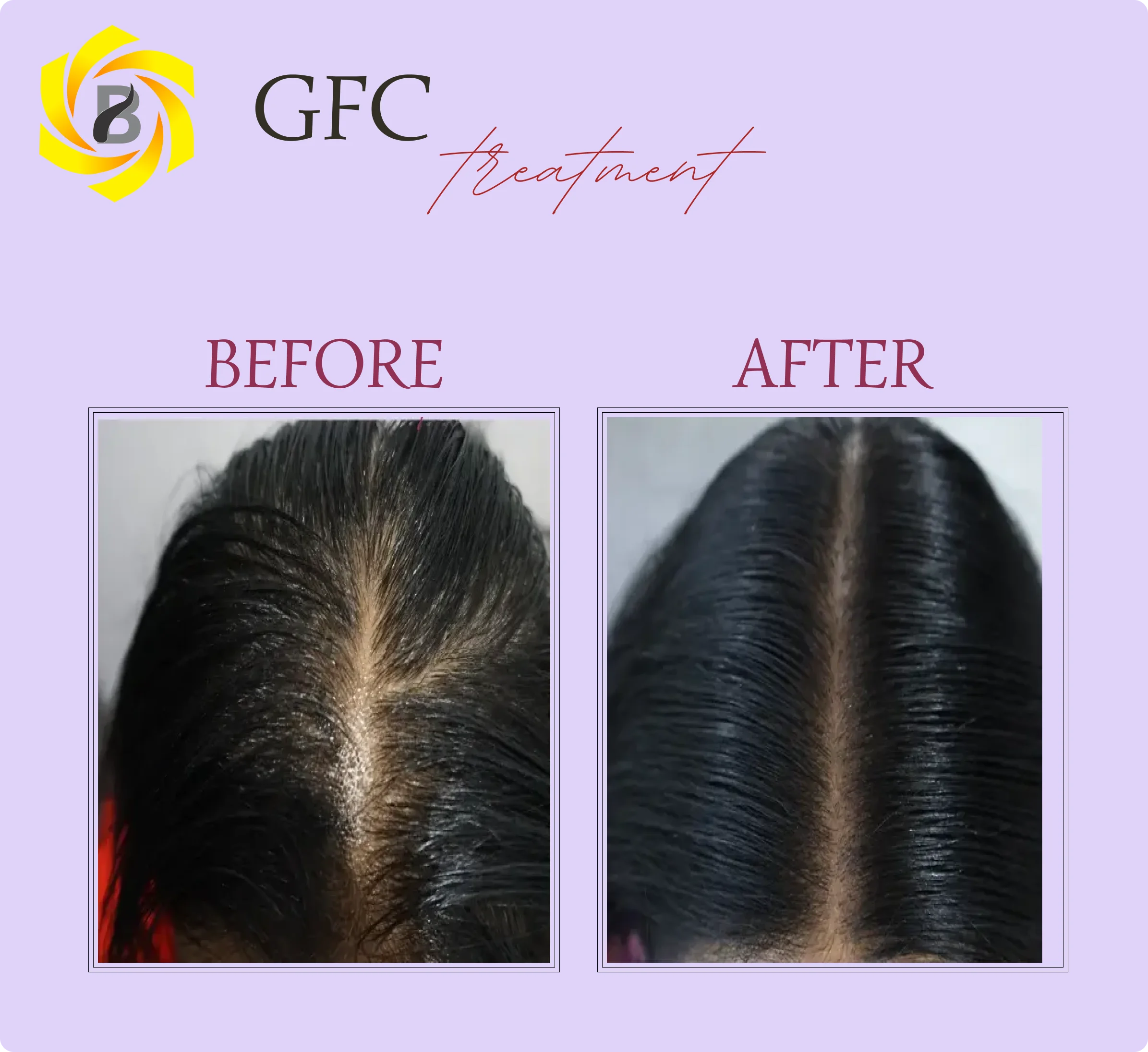 Before & After Result 5