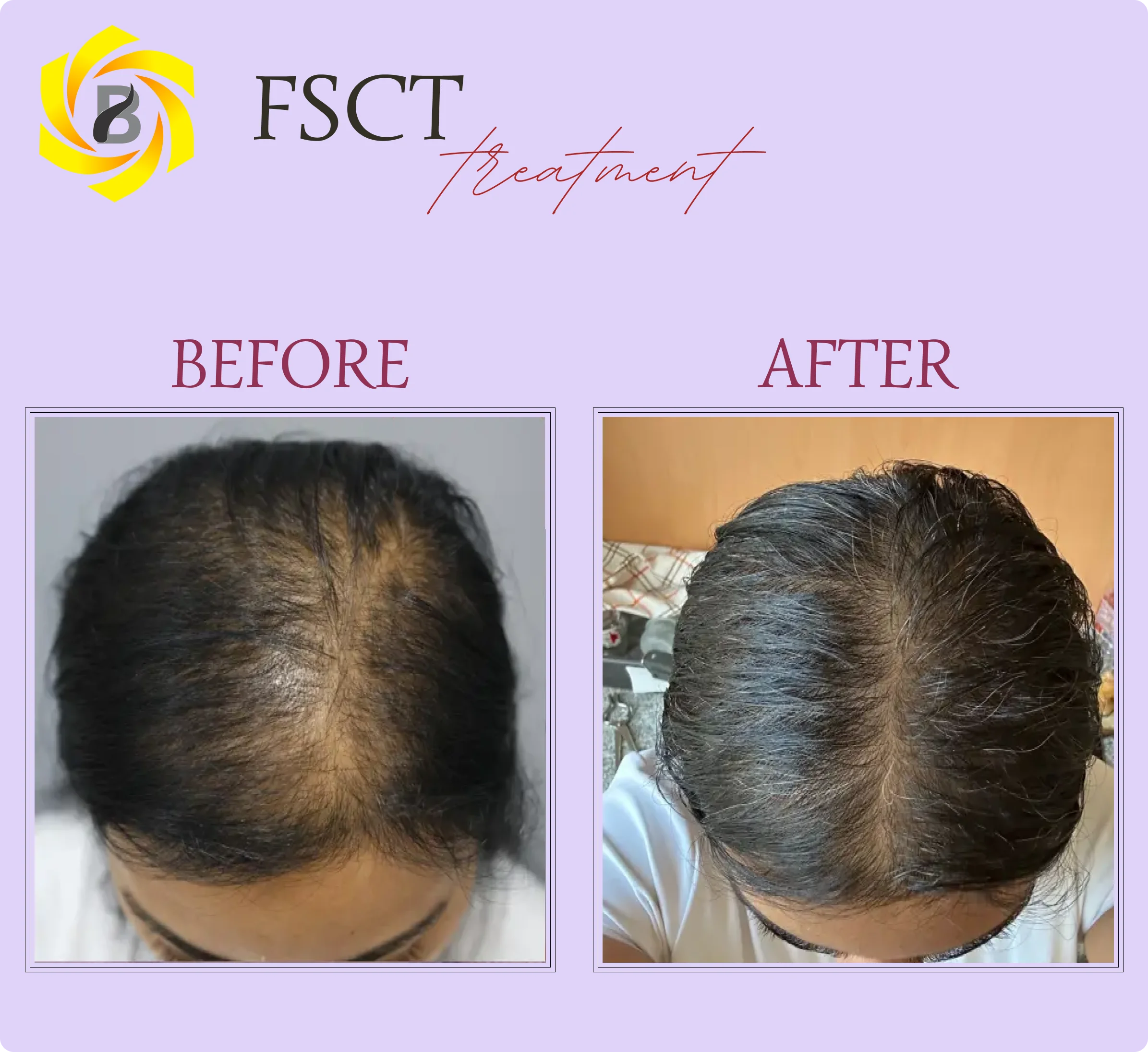 Before & After Result 6
