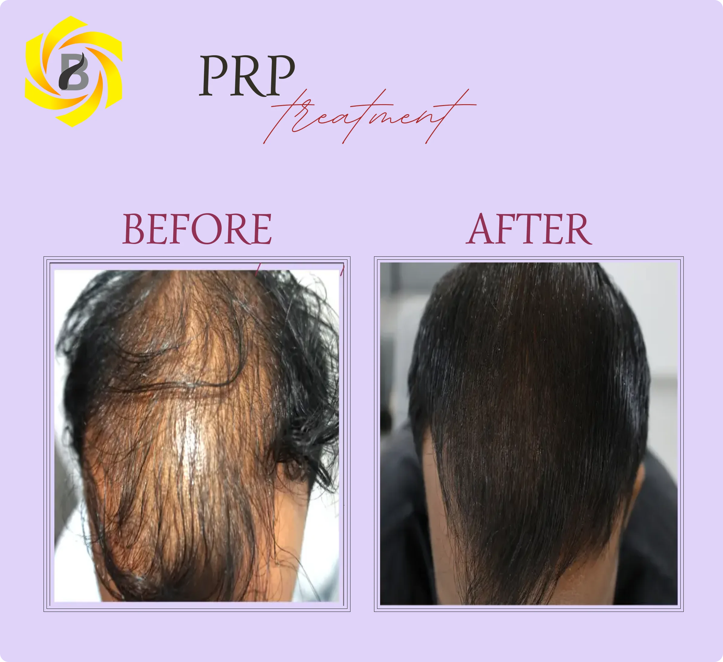 Before & After Result 6